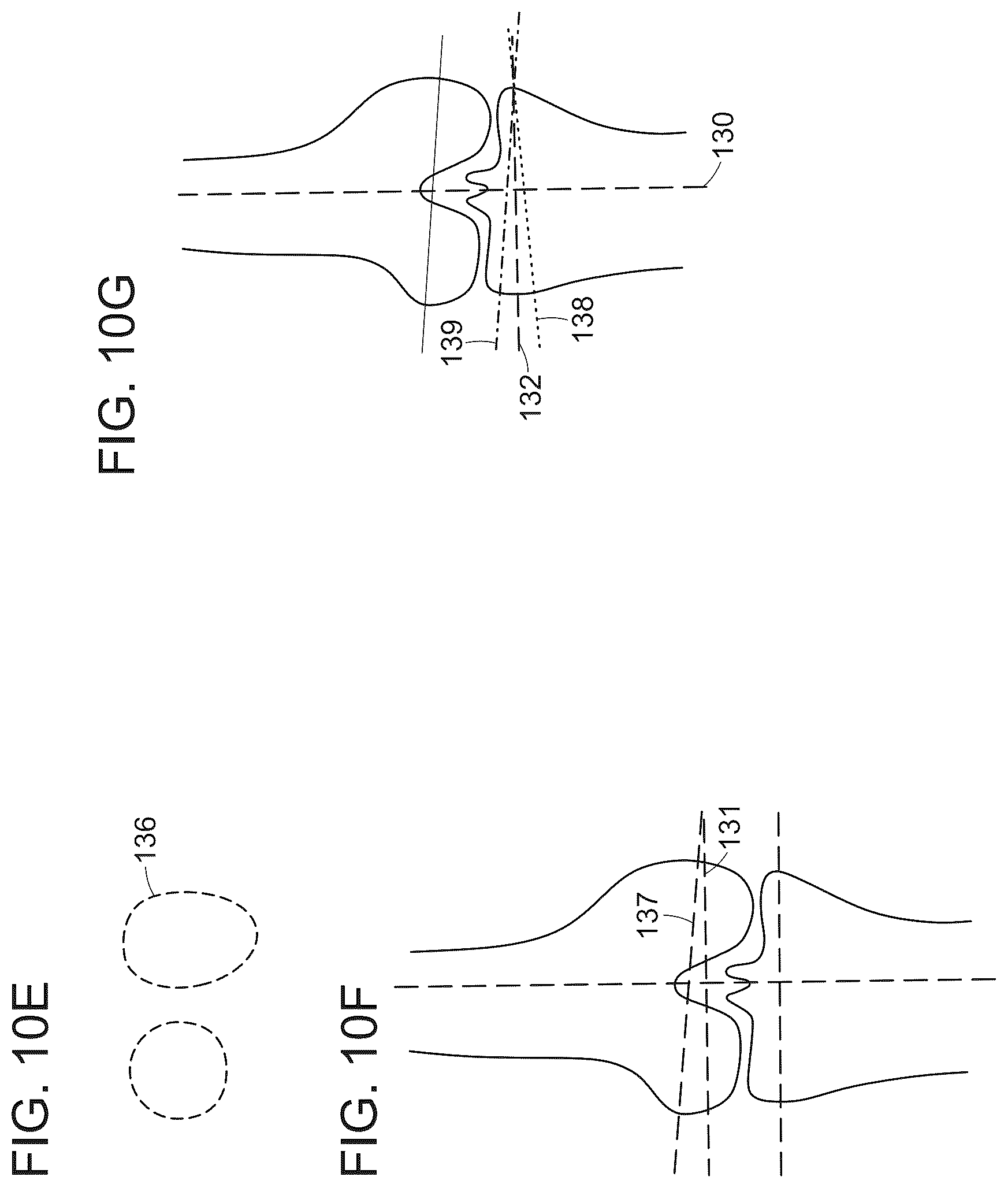 Patent US12488480 Figure 15 – Augmented reality guidance for surgical procedures