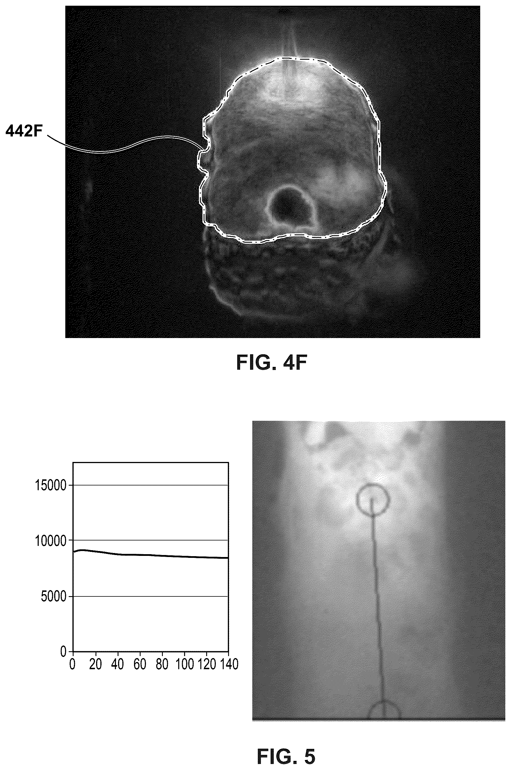 Patent US12488498 Figure 9 – Thermography measurements in heating process using pseudocalibration of thermal images