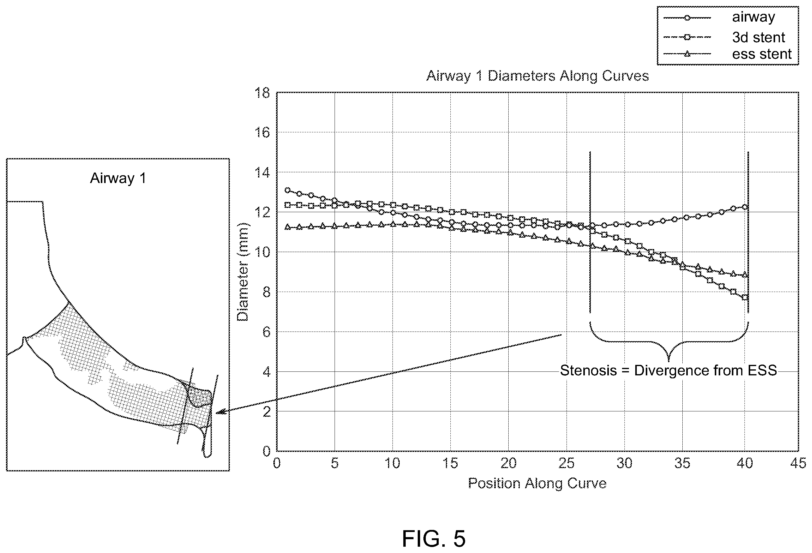 Patent US12488534 Figure 5 – Enhanced stock stents based on population modeling of tubular anatomical structures