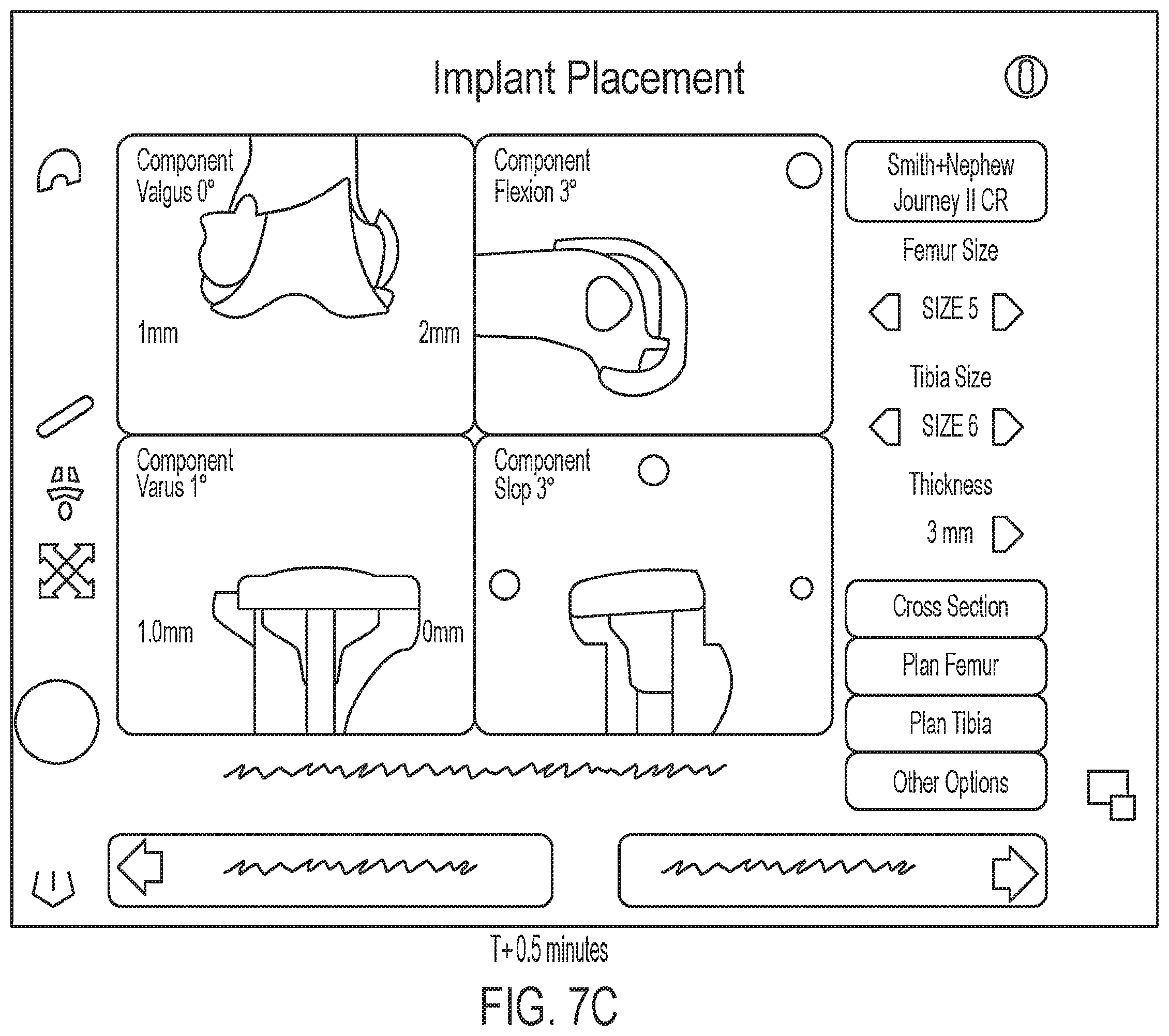 Patent US12488588 Figure 11 – Methods for arthroscopic video analysis and devices therefor