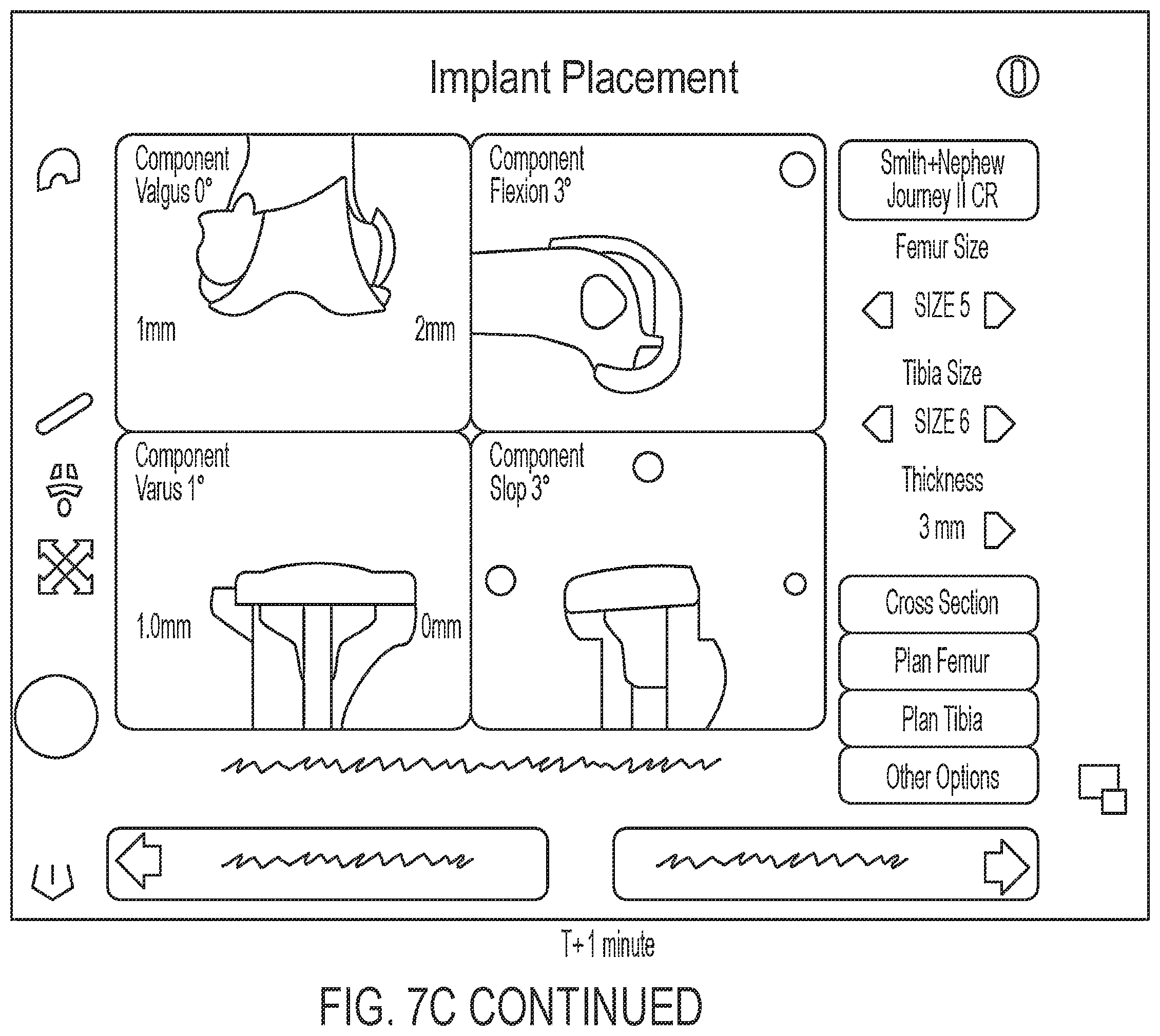 Patent US12488588 Figure 12 – Methods for arthroscopic video analysis and devices therefor