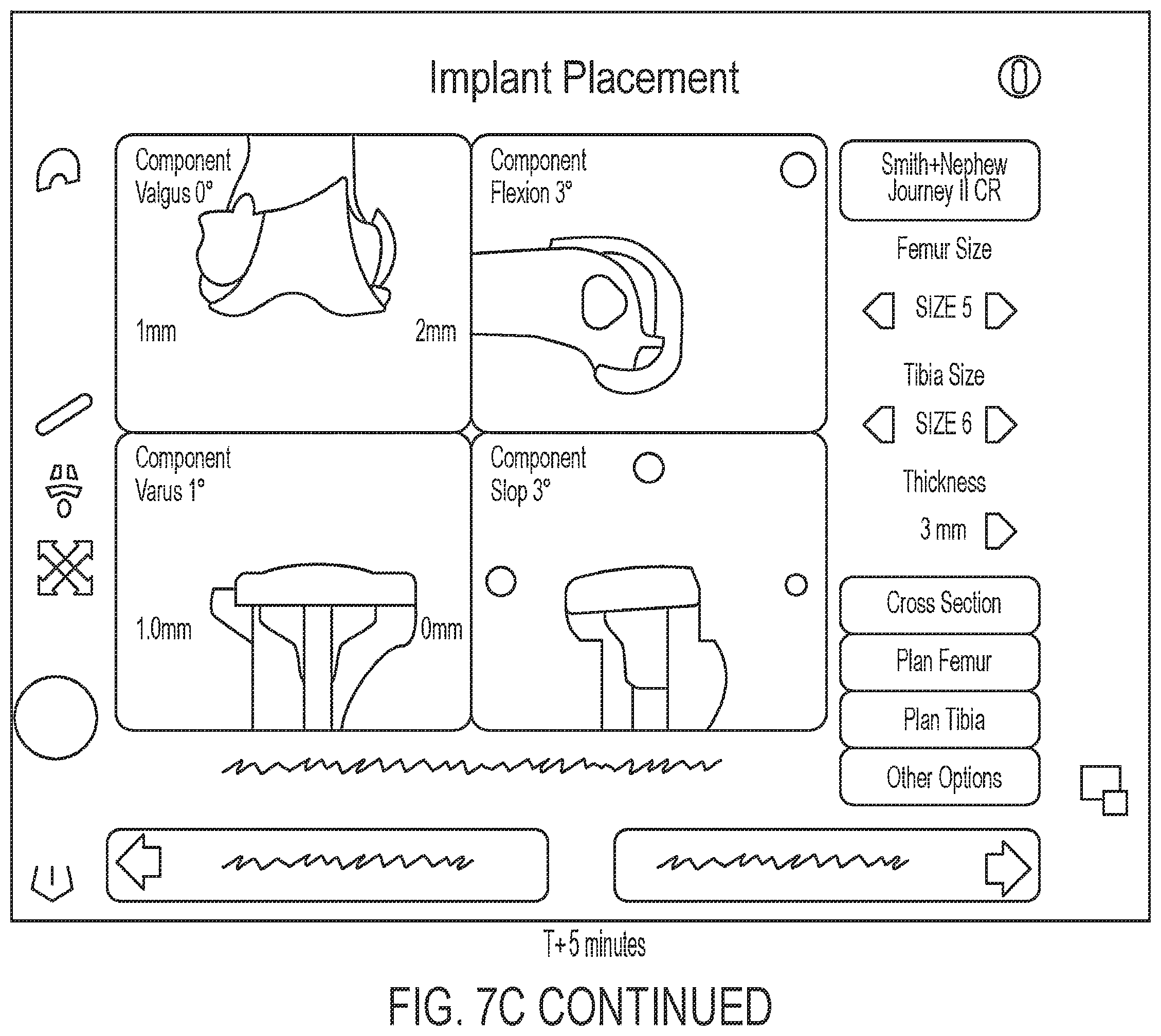 Patent US12488588 Figure 13 – Methods for arthroscopic video analysis and devices therefor