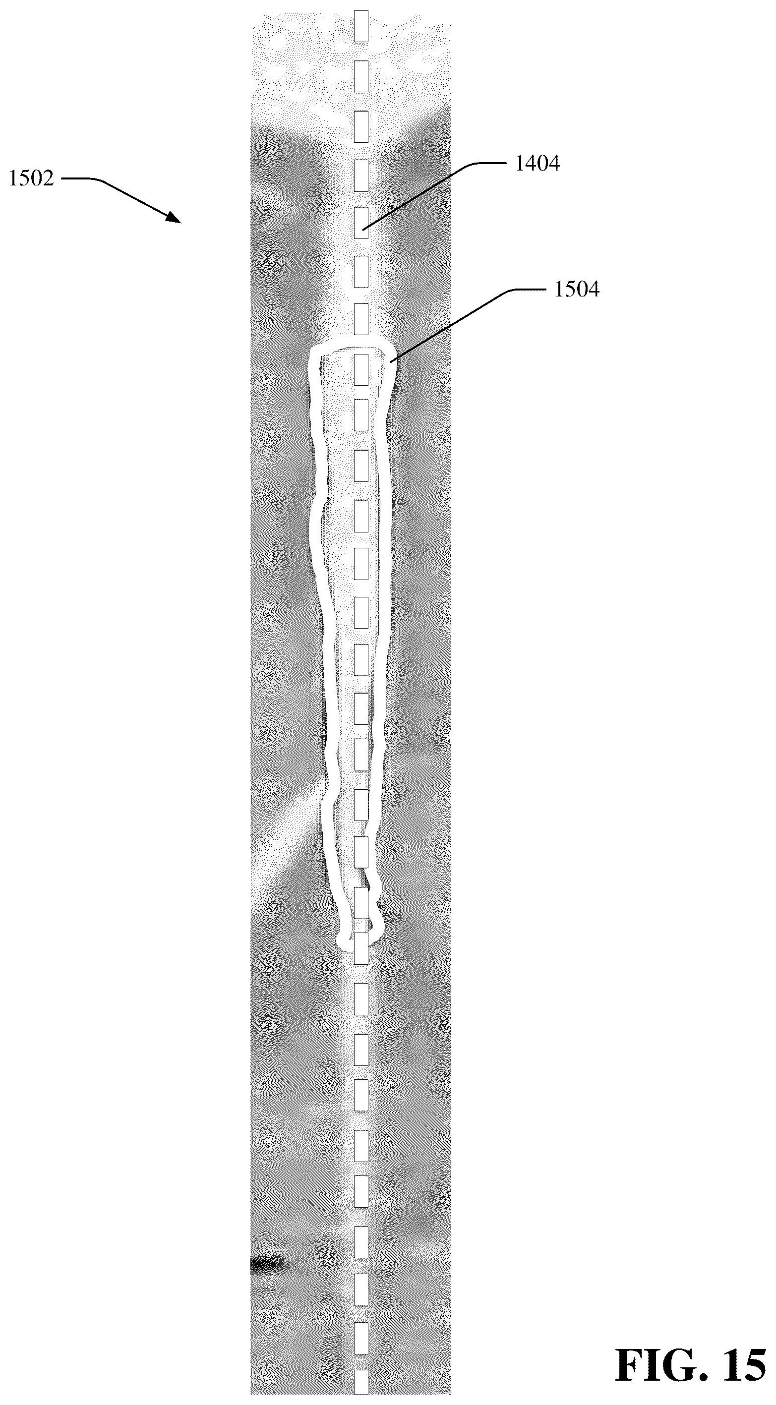 Patent US12488876 Figure 15 – Ease of image annotation via curved planar reformation