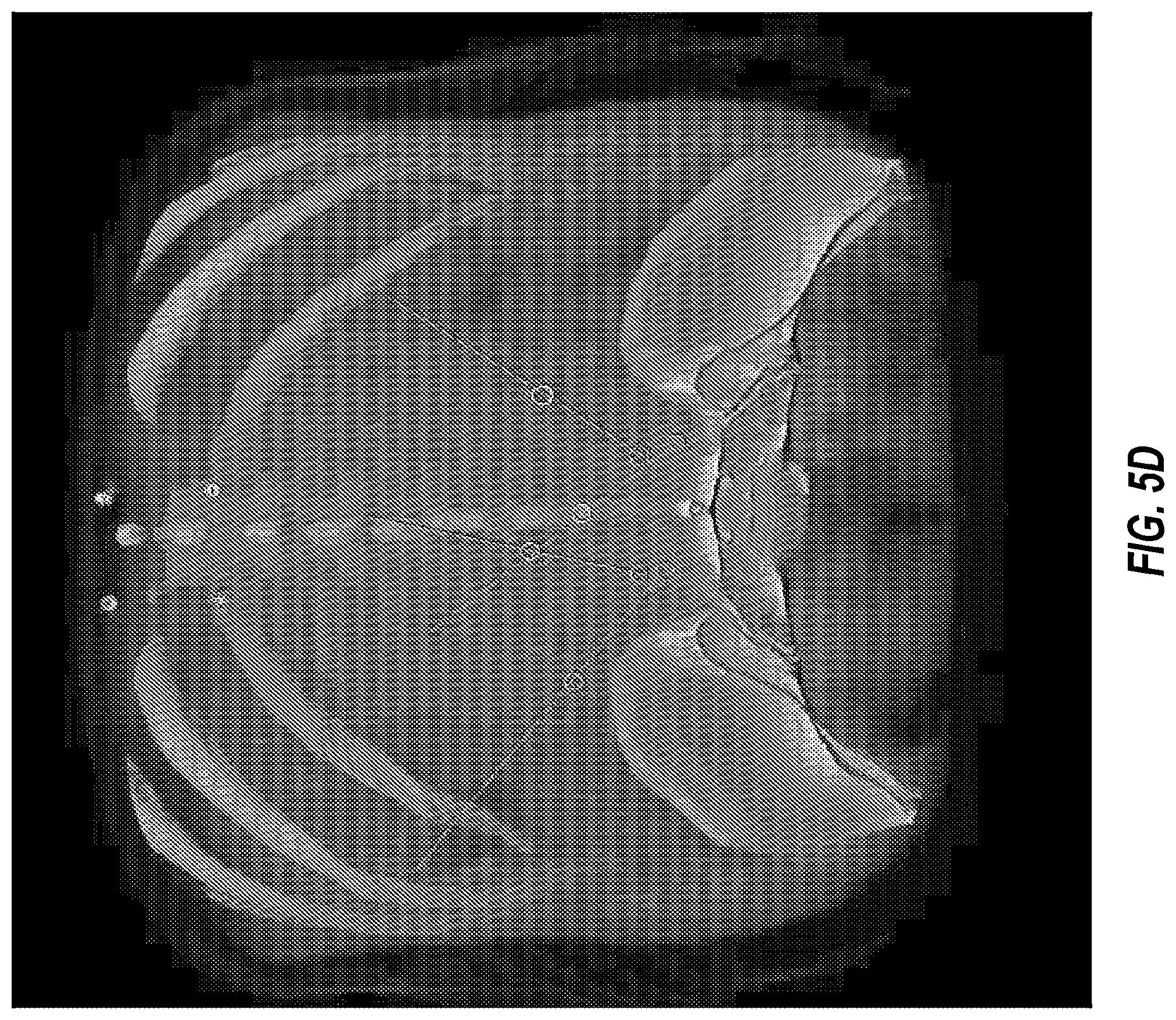 Patent US12488878 Figure 8 – Aligning image data of a patient with actual views of the patient using an optical code affixed to the patient