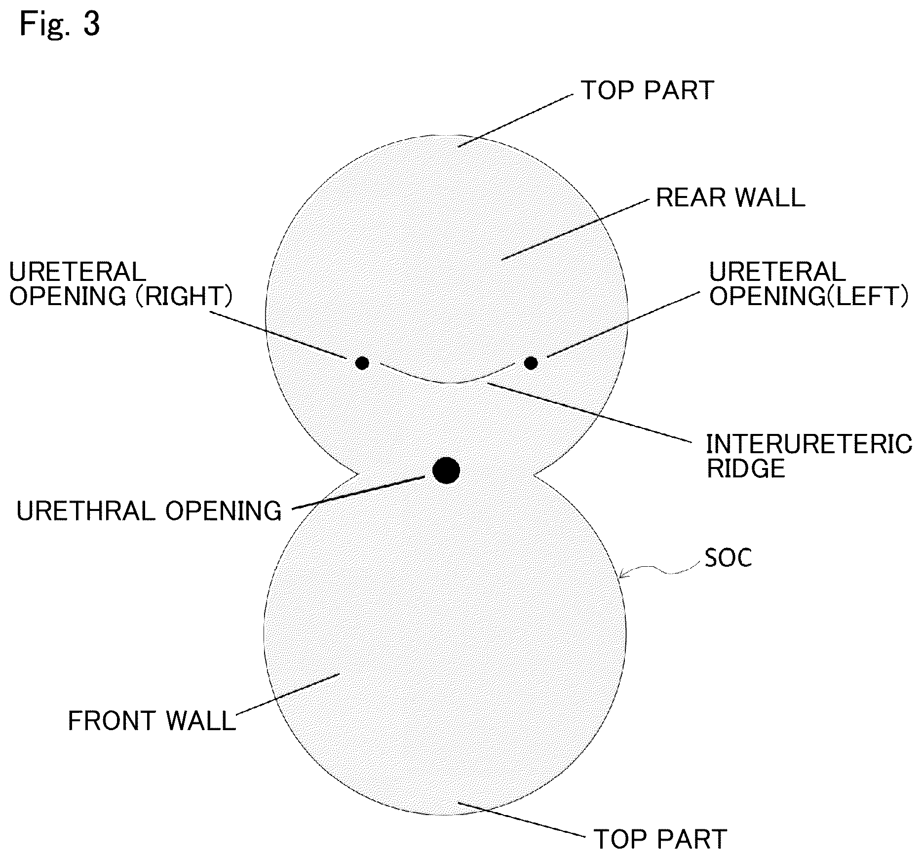 Patent US12488896 Figure 3 – Method and system for endoscopic diagnosis support