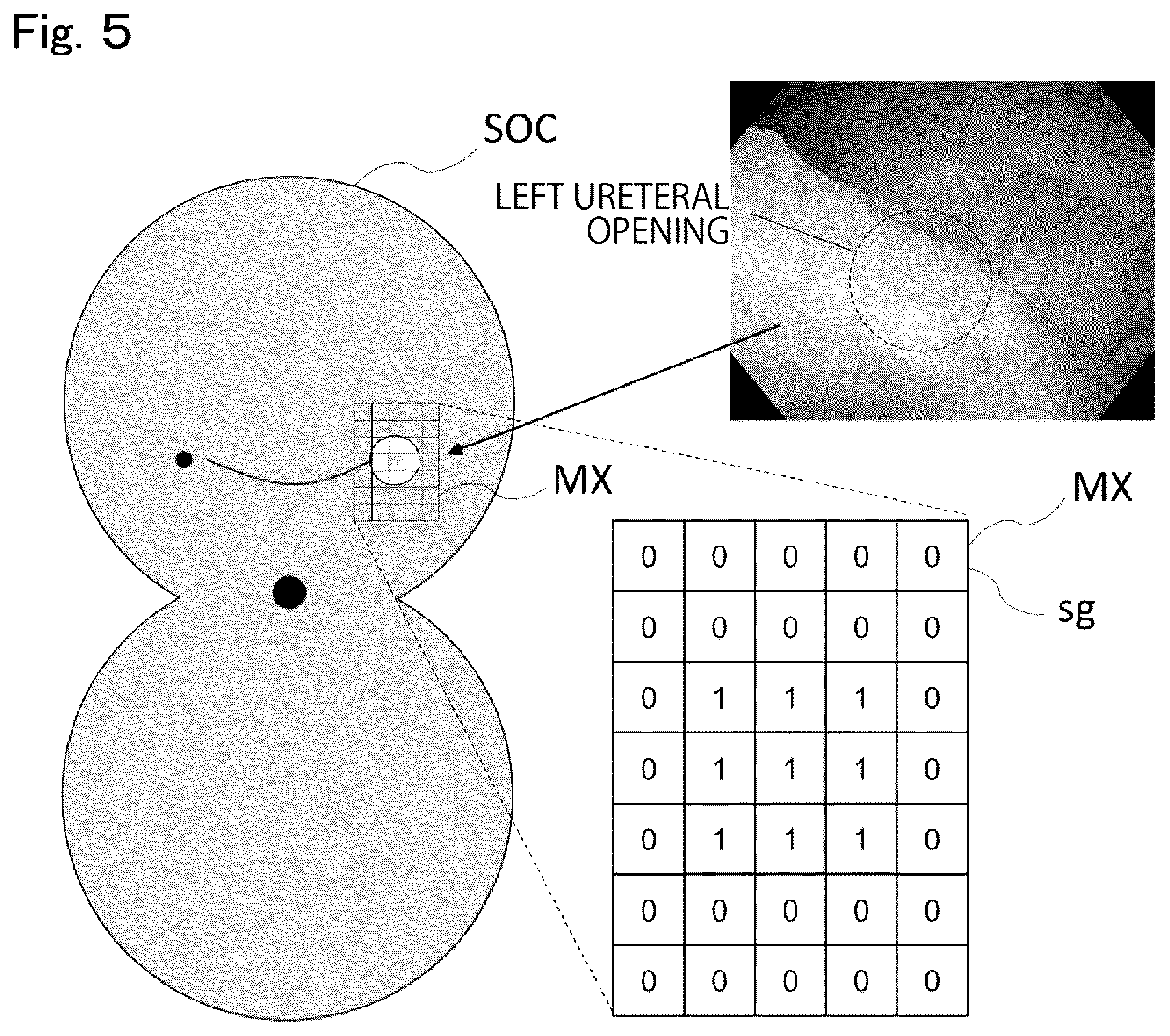 Patent US12488896 Figure 5 – Method and system for endoscopic diagnosis support