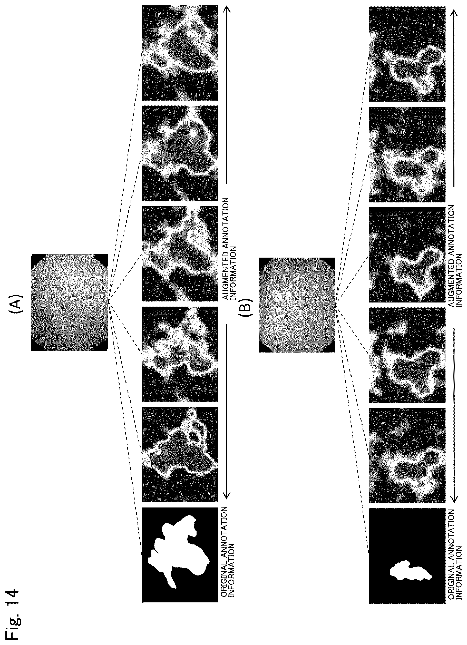 Patent US12488896 Figure 15 – Method and system for endoscopic diagnosis support