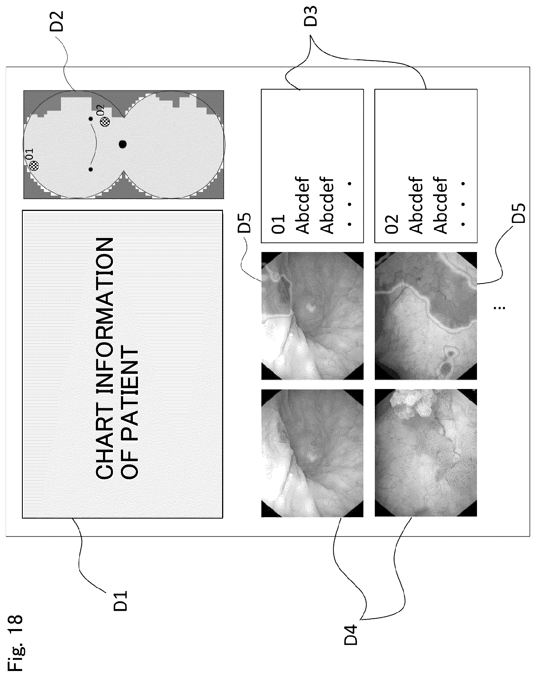 Patent US12488896 Figure 19 – Method and system for endoscopic diagnosis support