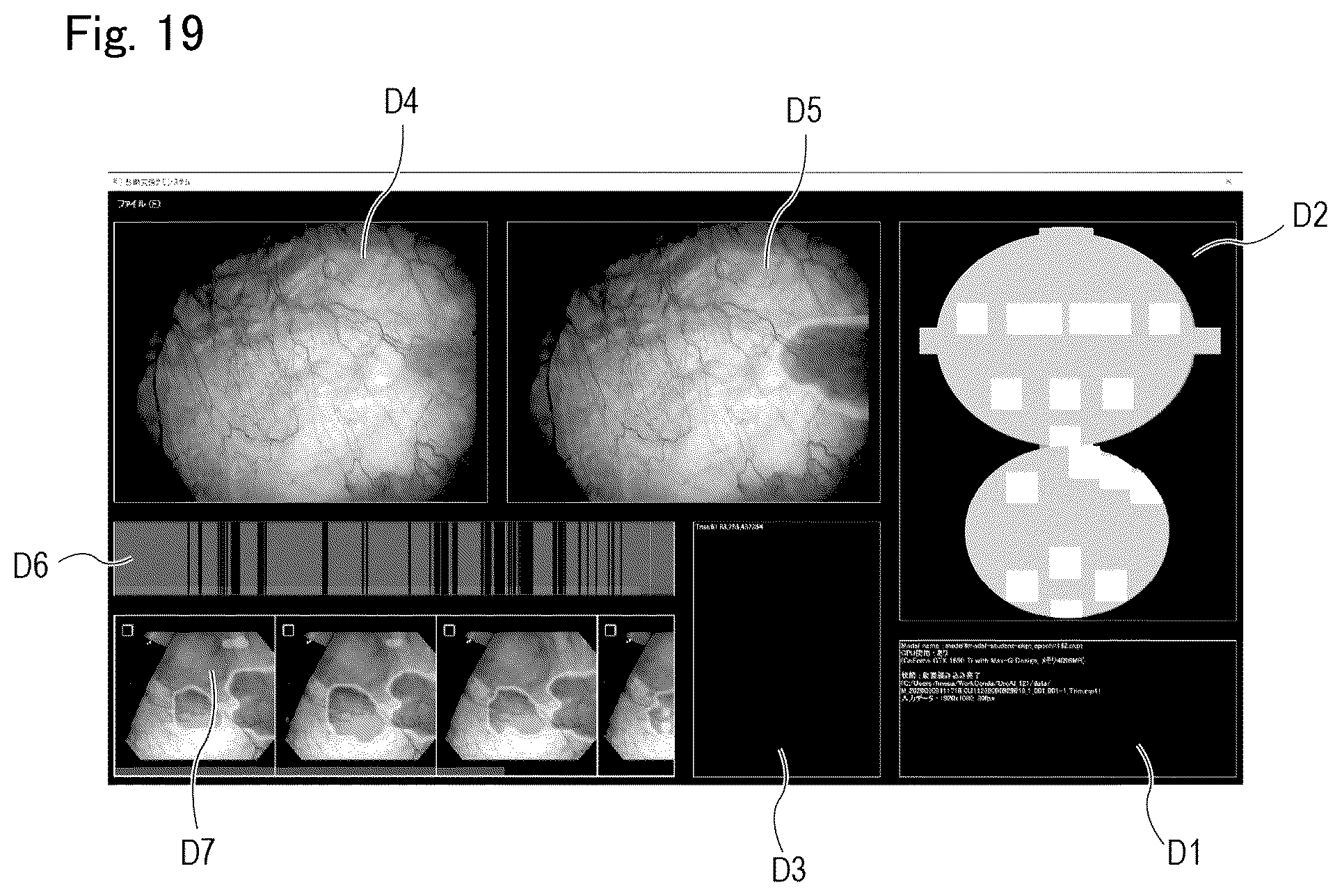 Patent US12488896 Figure 20 – Method and system for endoscopic diagnosis support