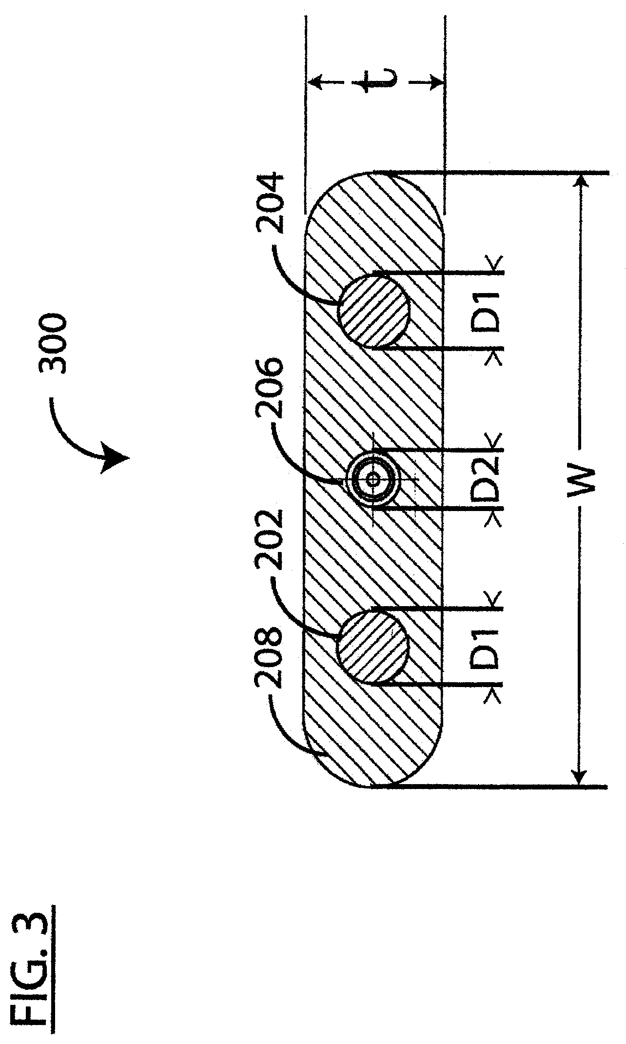 Patent US12488913 Figure 4 – Guarded coaxial cable assembly