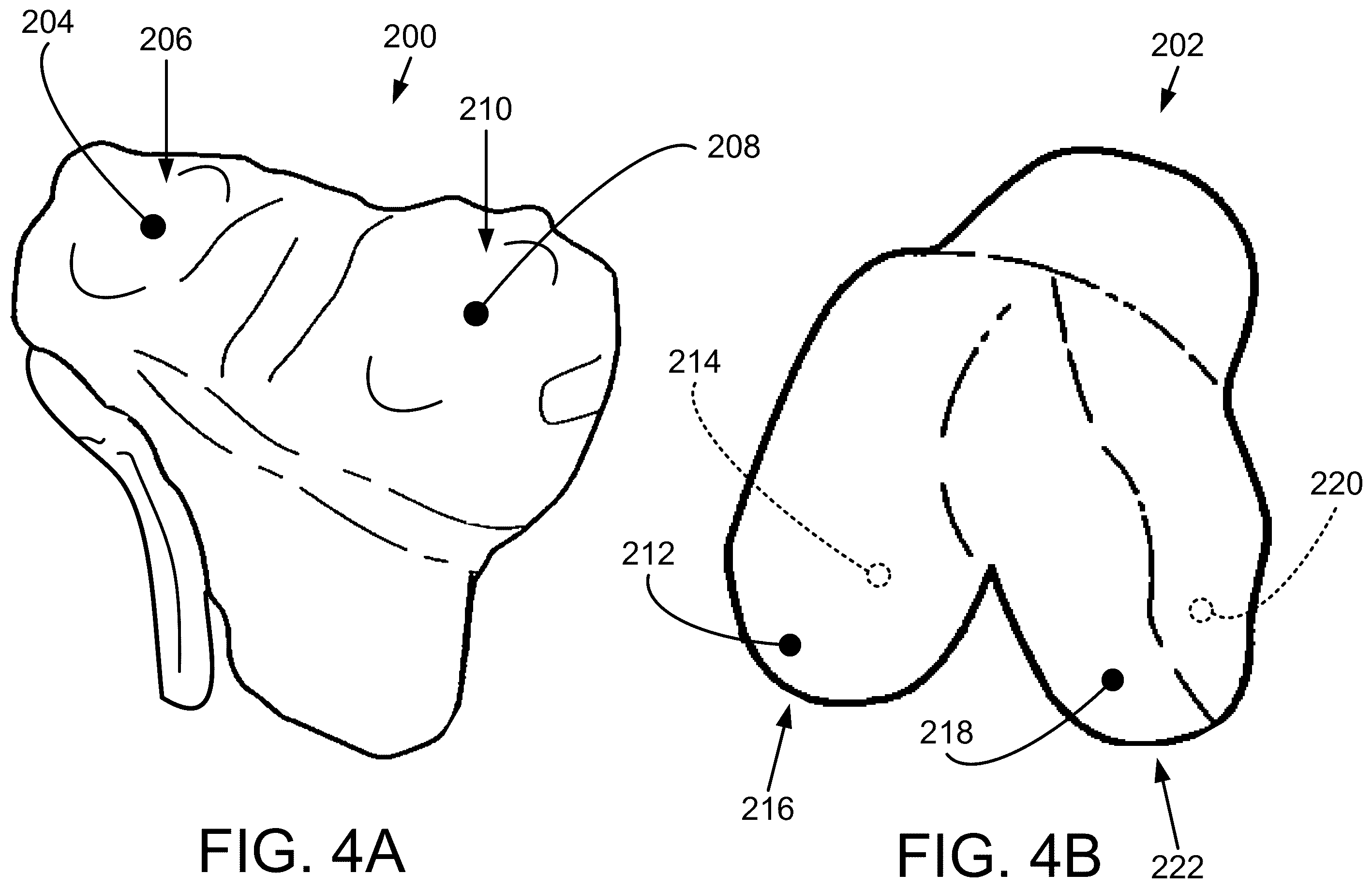 Patent US12491031 Figure 4 – Preoperative planning and associated intraoperative registration for a surgical system