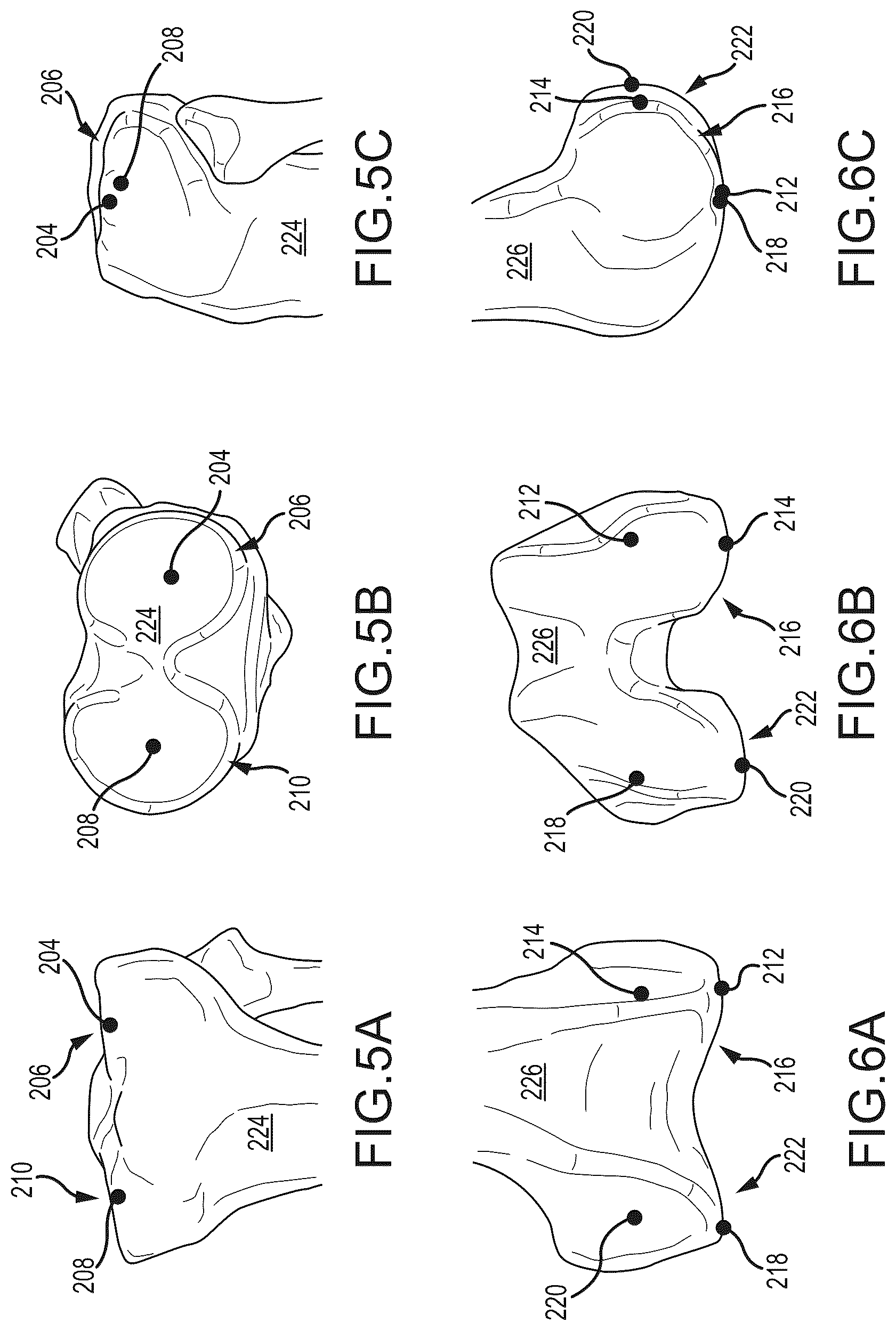 Patent US12491031 Figure 5 – Preoperative planning and associated intraoperative registration for a surgical system