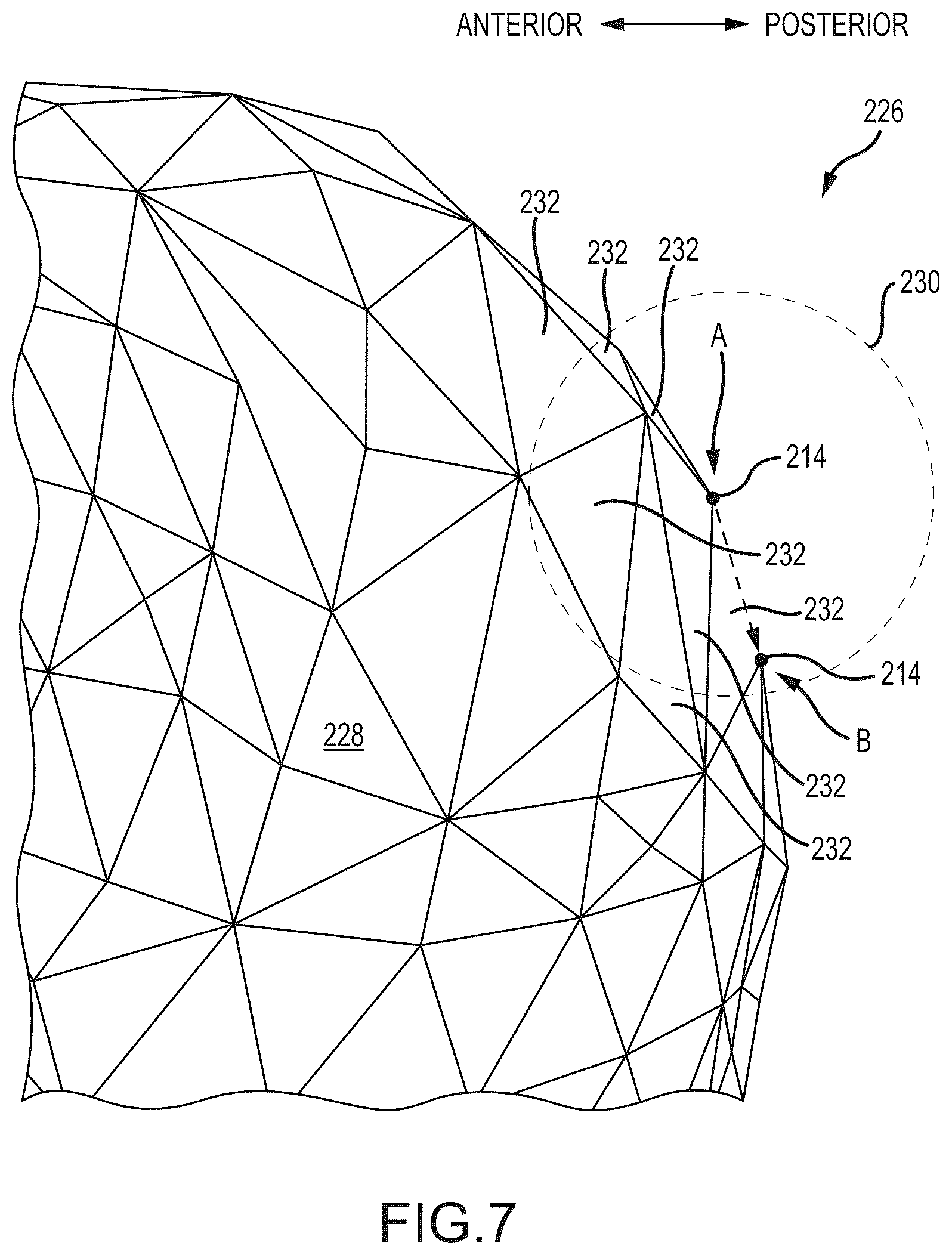 Patent US12491031 Figure 6 – Preoperative planning and associated intraoperative registration for a surgical system
