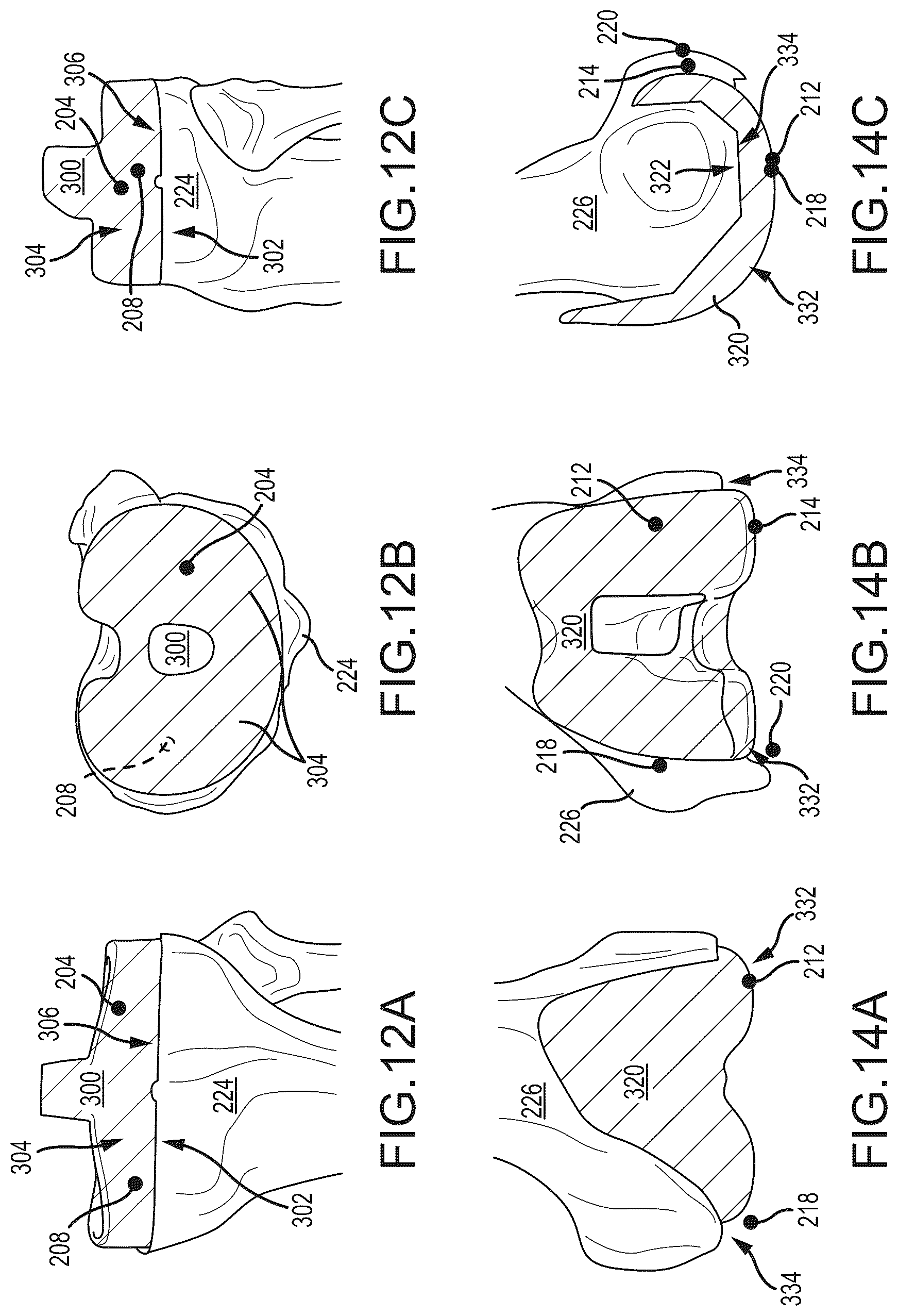 Patent US12491031 Figure 15 – Preoperative planning and associated intraoperative registration for a surgical system