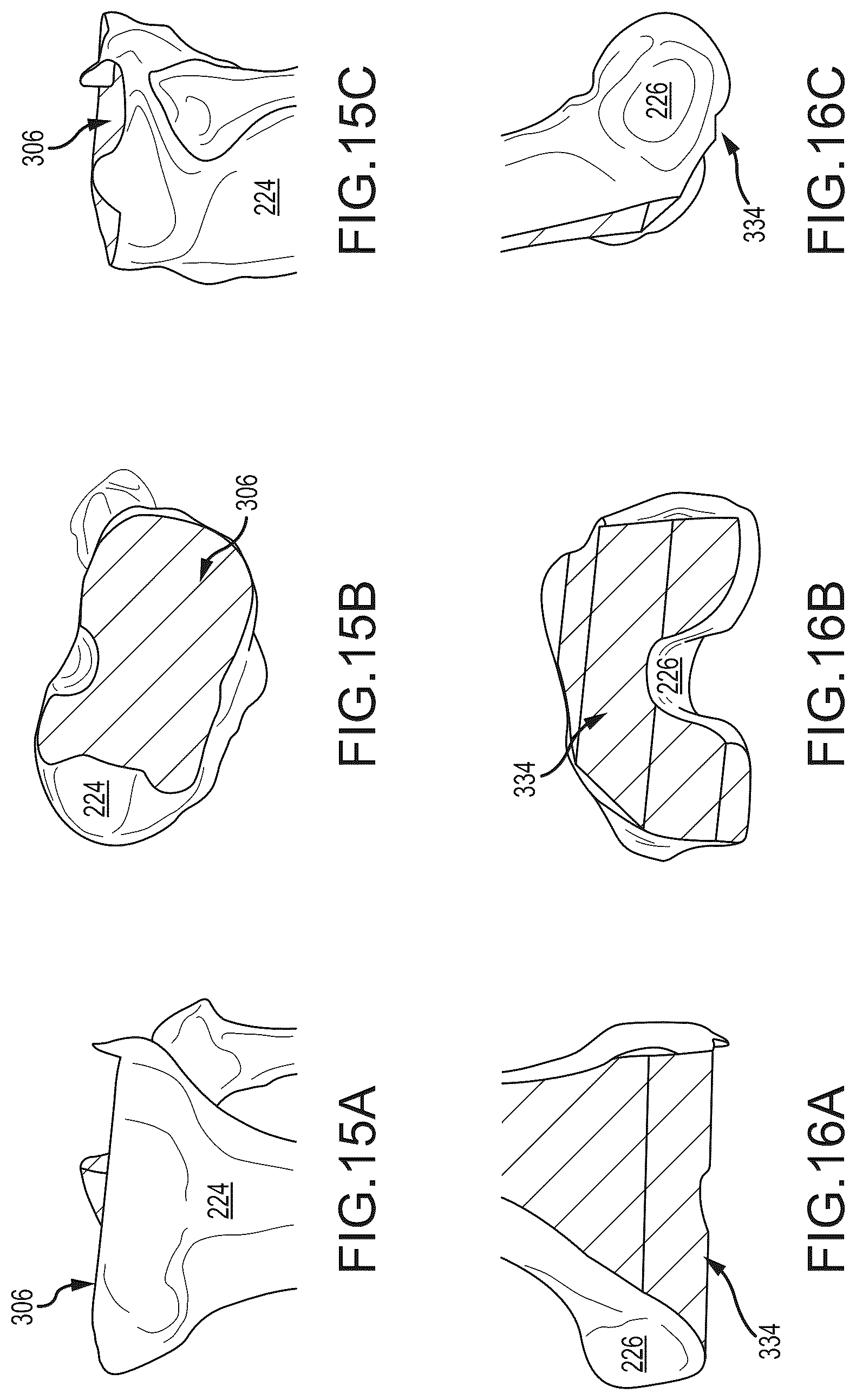 Patent US12491031 Figure 16 – Preoperative planning and associated intraoperative registration for a surgical system