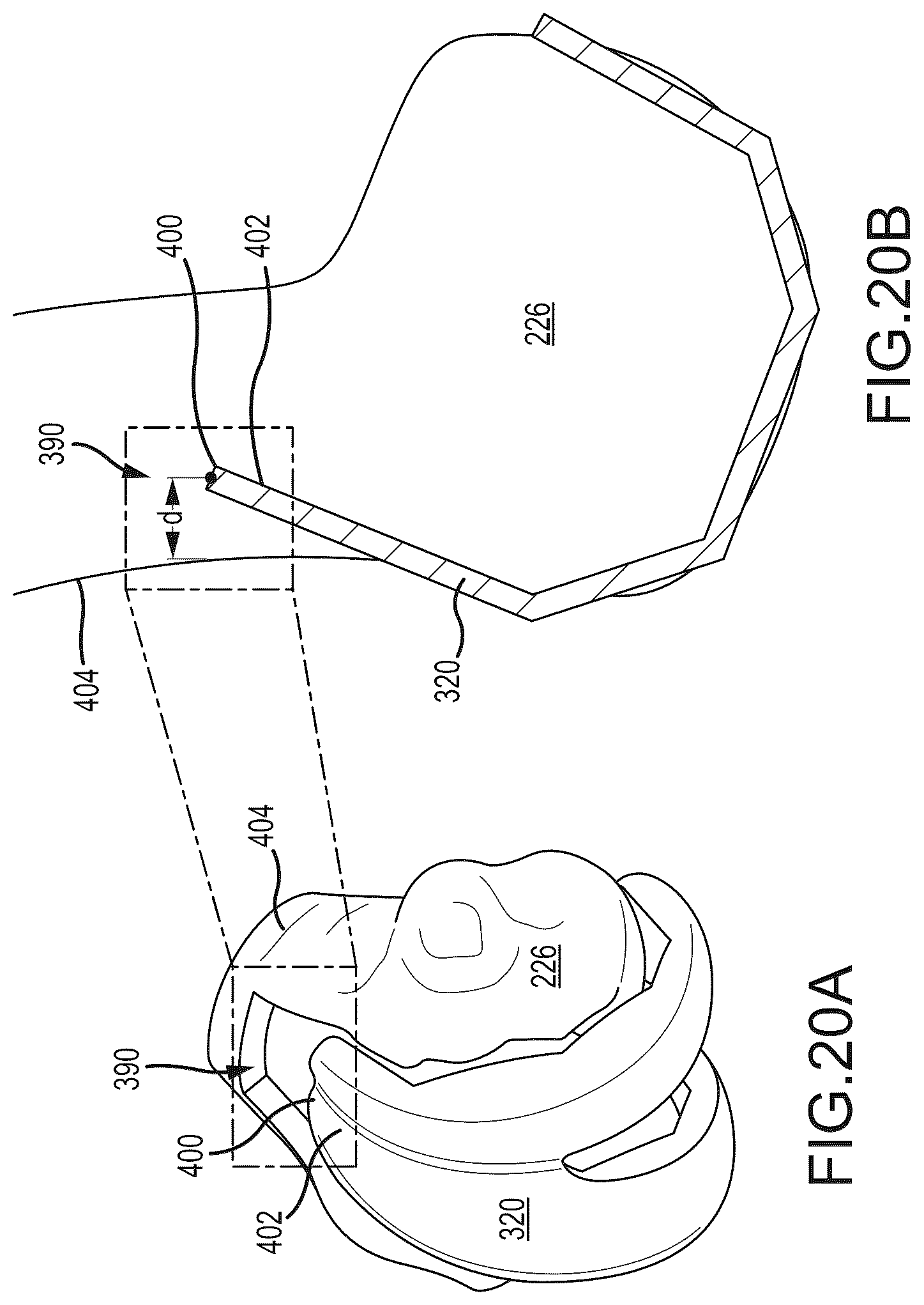 Patent US12491031 Figure 20 – Preoperative planning and associated intraoperative registration for a surgical system