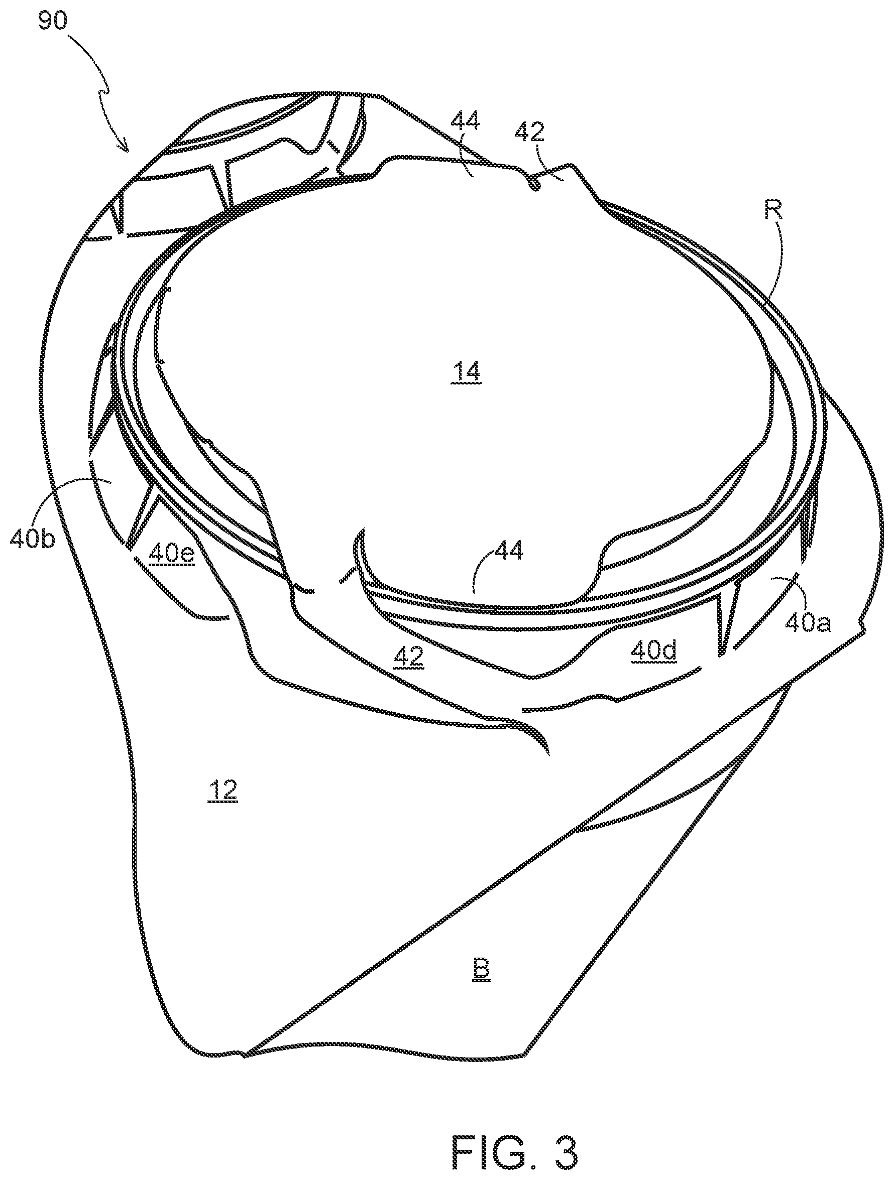 Patent US12492054 Figure 3 – Article engaging structure, article carrier, and blank for forming the same