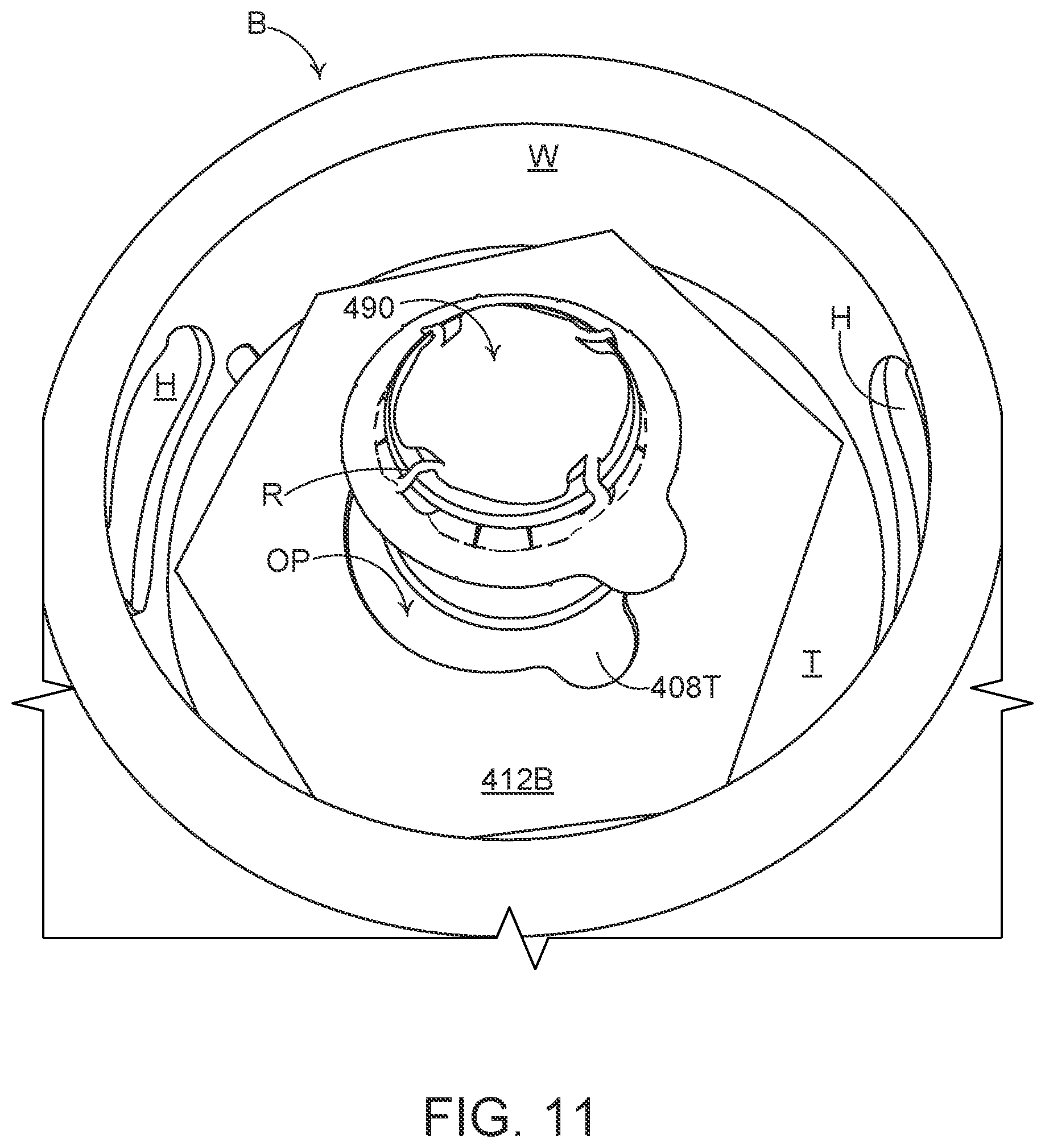 Patent US12492054 Figure 11 – Article engaging structure, article carrier, and blank for forming the same