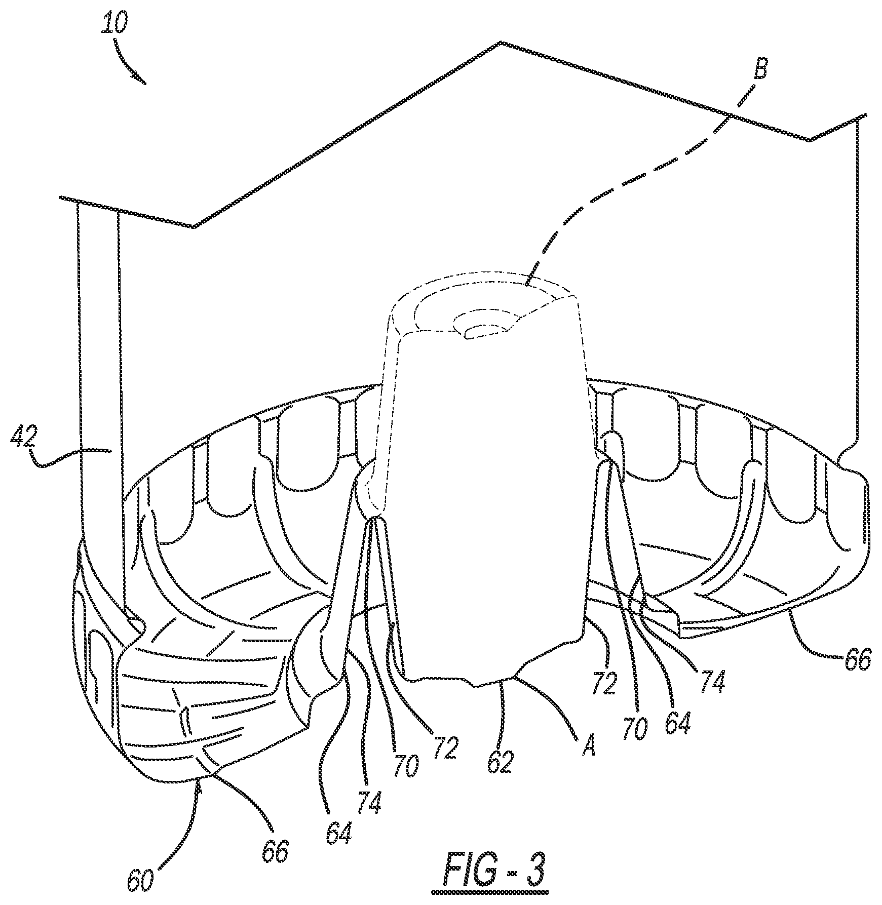 Patent US12492058 Figure 3 – Vertical displacement container base