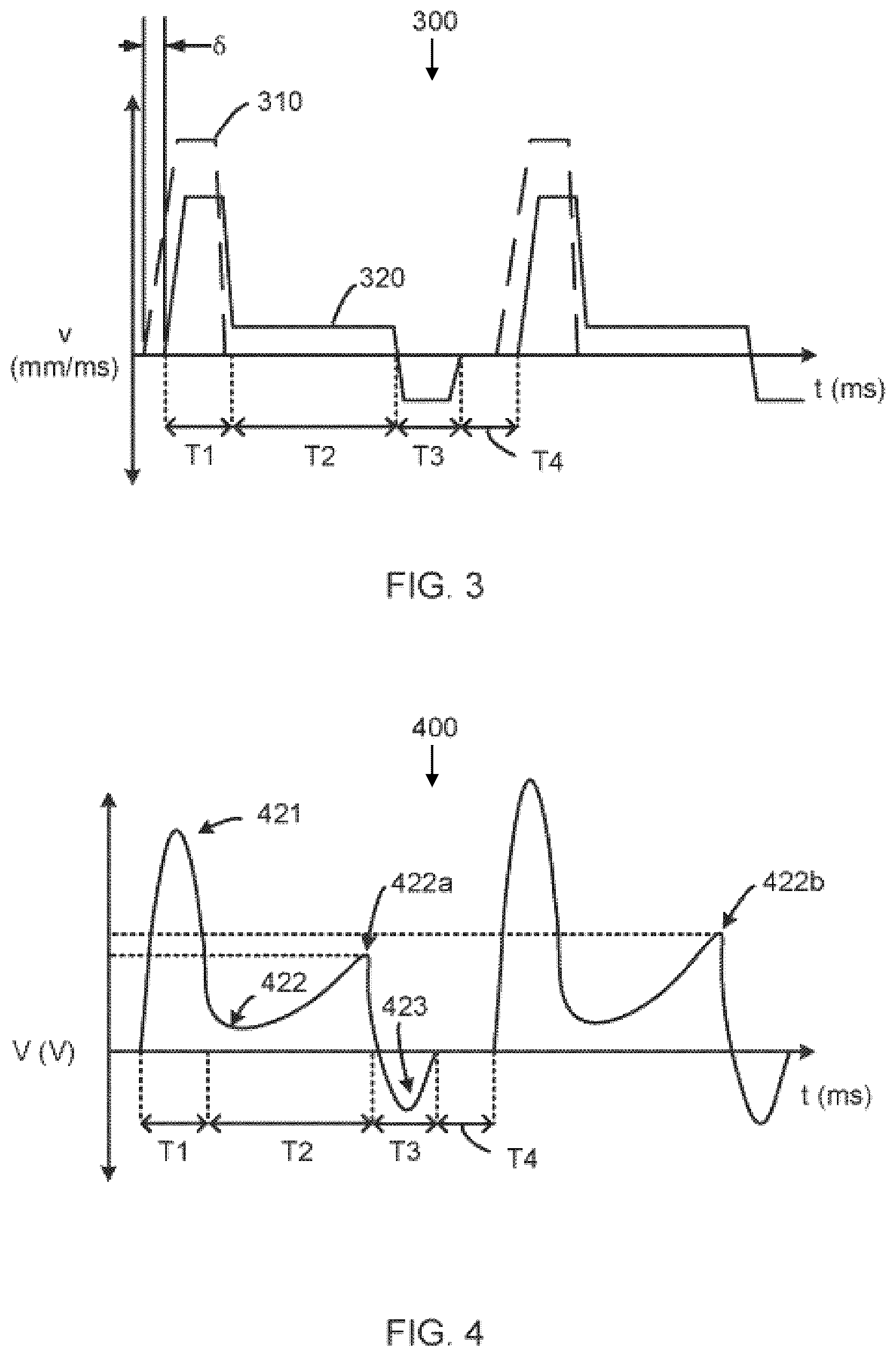 Patent US12492092 Figure 2 – Media collecting
