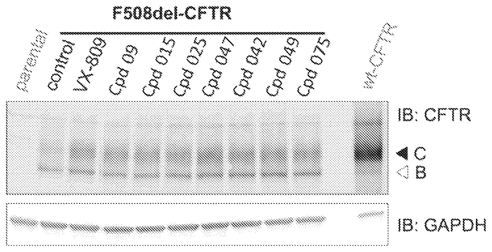 Patent US12492193 Figure 1 – Pyrazole derivatives for the treatment of cystic fibrosis