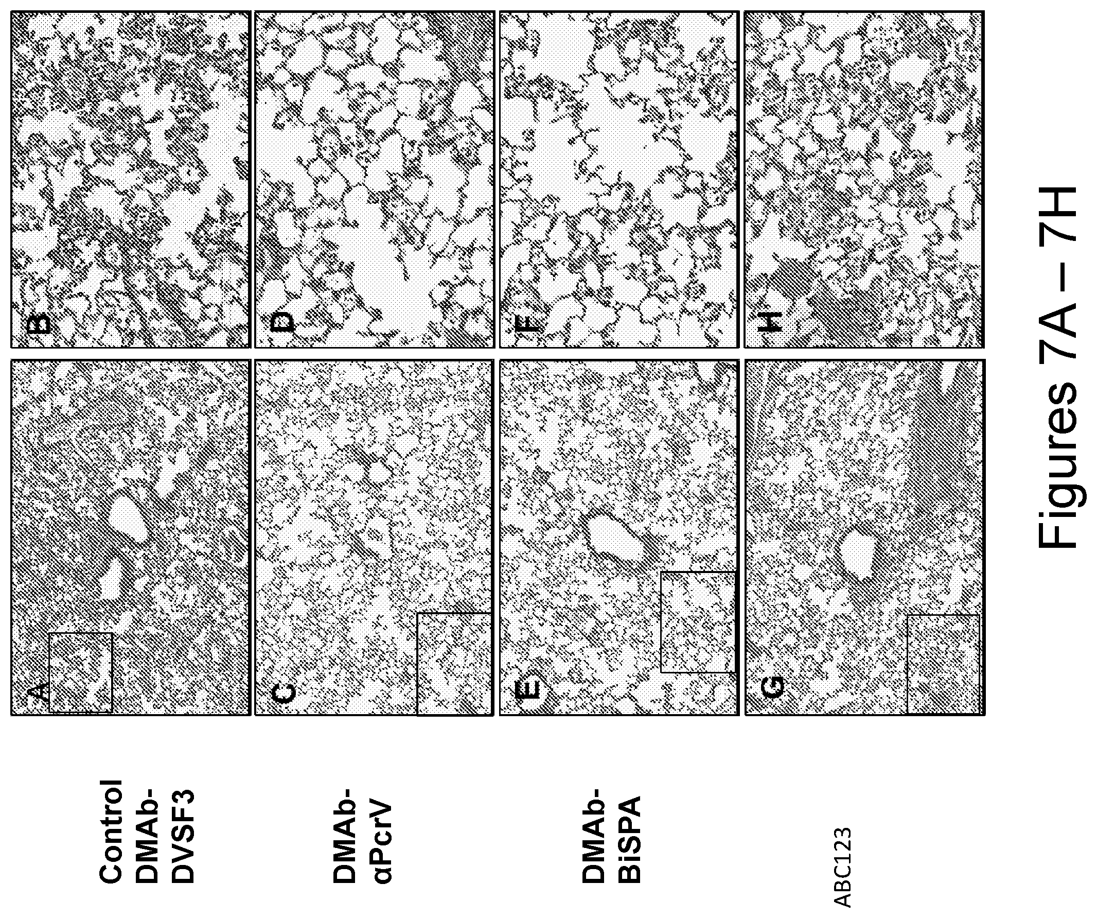 Patent US12492243 Figure 8 – DNA antibody constructs for use against Pseudomonas aeruginosa