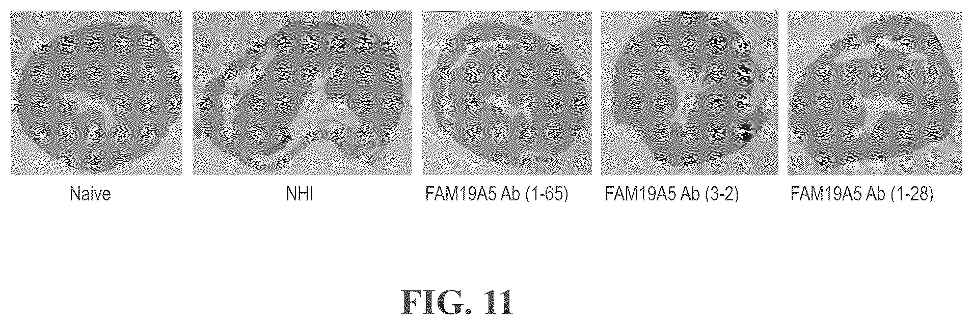 Patent US12492246 Figure 12 – Anti-FAM19A5 antibodies and uses thereof