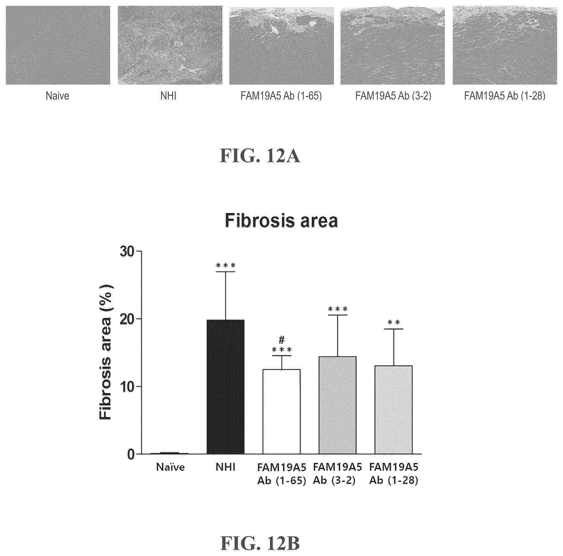 Patent US12492246 Figure 13 – Anti-FAM19A5 antibodies and uses thereof
