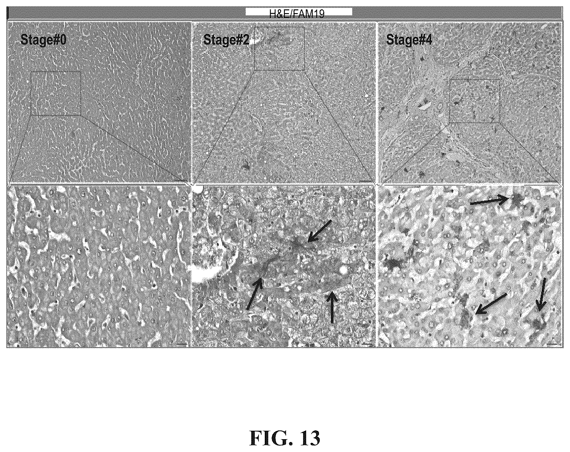 Patent US12492246 Figure 14 – Anti-FAM19A5 antibodies and uses thereof