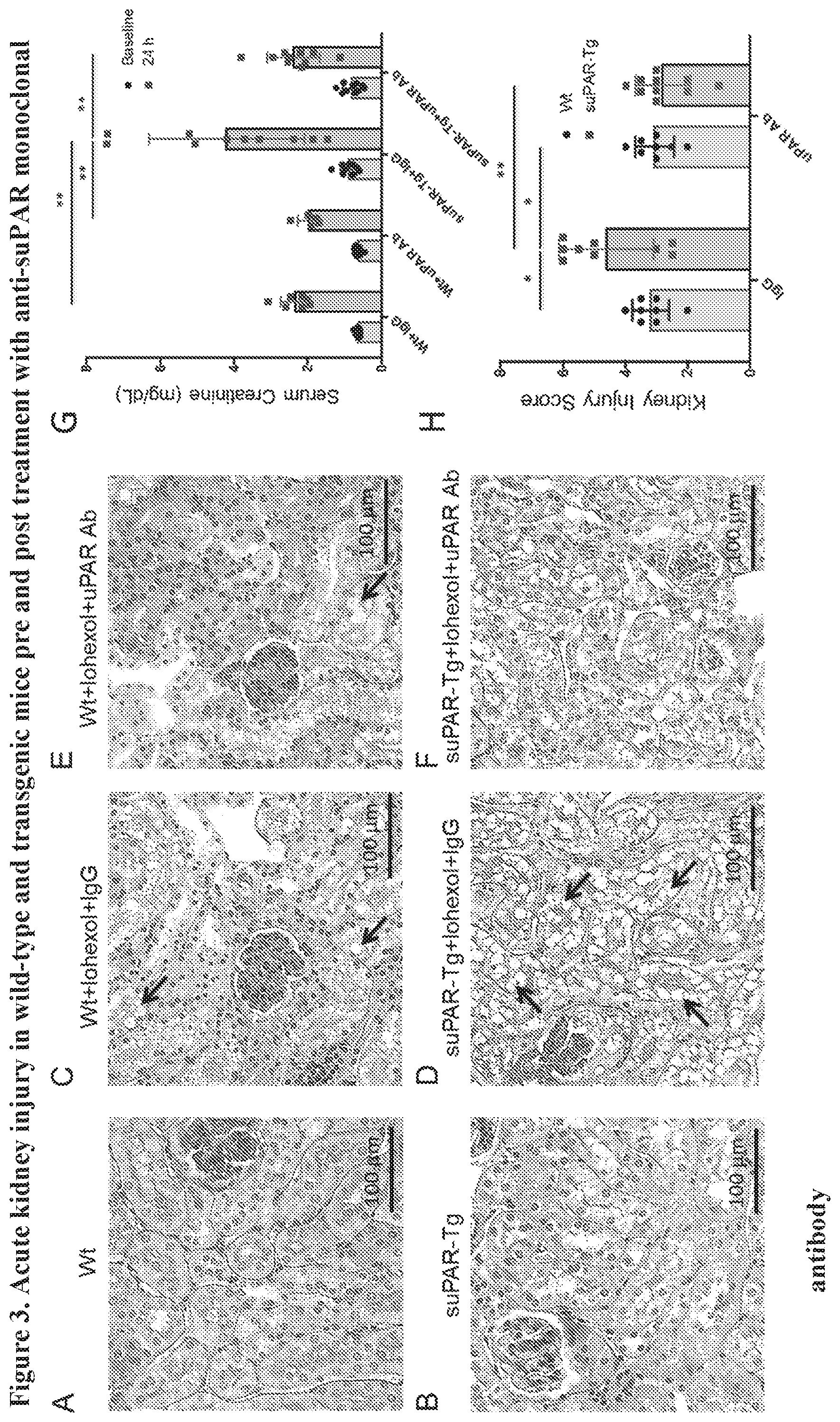 Patent US12492250 Figure 5 – suPAR and prediction and treatment of acute kidney injury