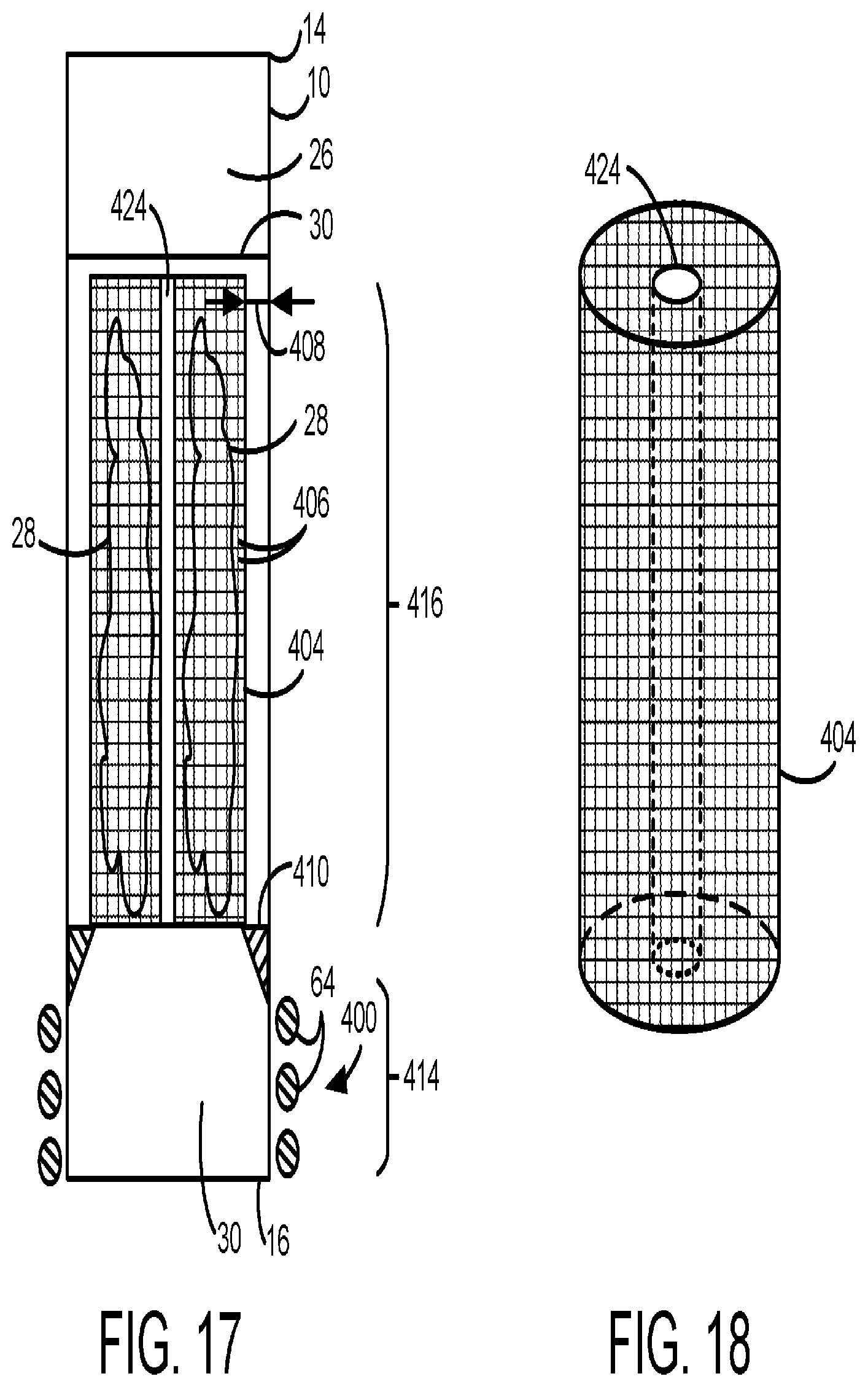 Patent US12492351 Figure 10 – Waste treatment system and method using energy recirculation techniques