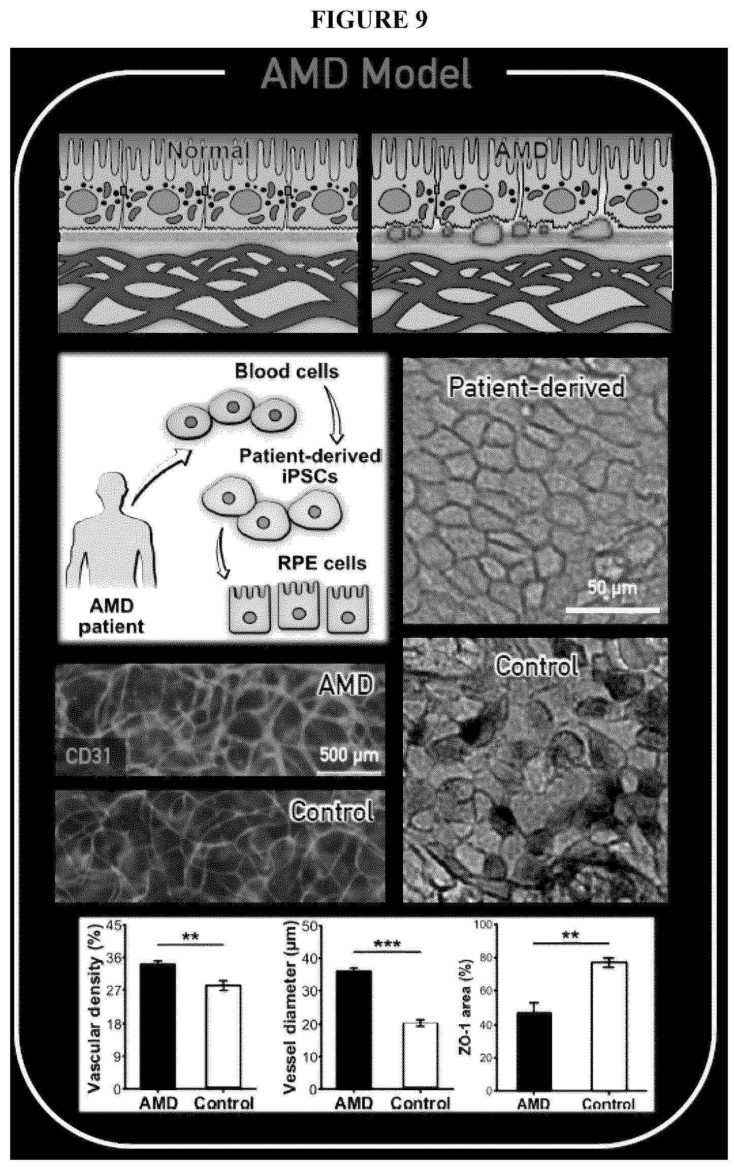 Patent US12492374 Figure 11 – Micro-engineered models of the human eye and methods of use