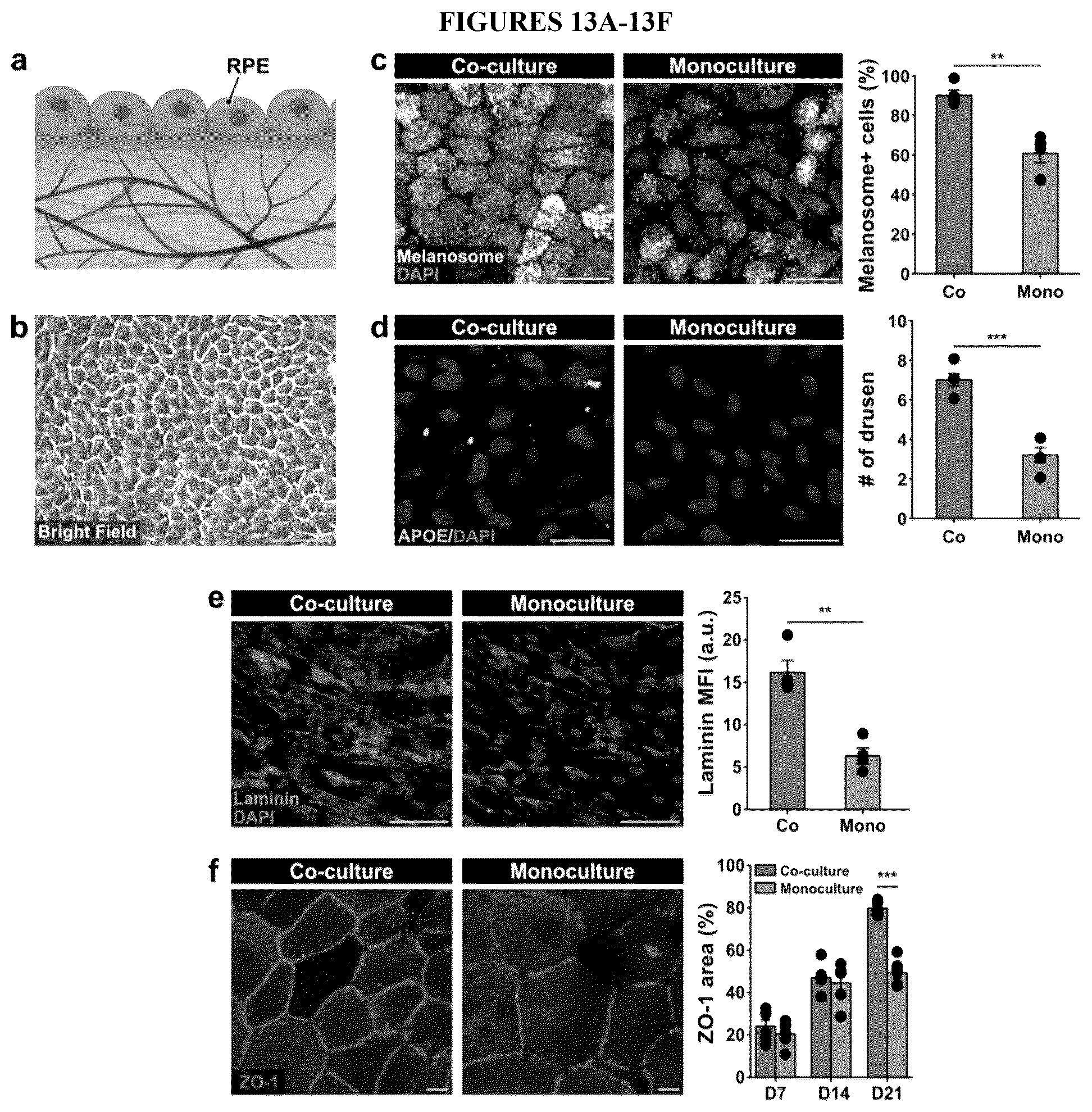 Patent US12492374 Figure 17 – Micro-engineered models of the human eye and methods of use