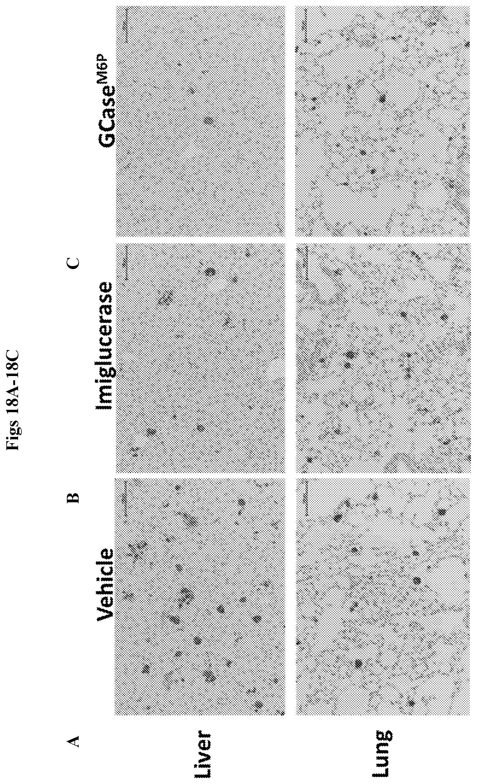 Patent US12492412 Figure 18 – Vector compositions and methods of using same for treatment of lysosomal storage disorders