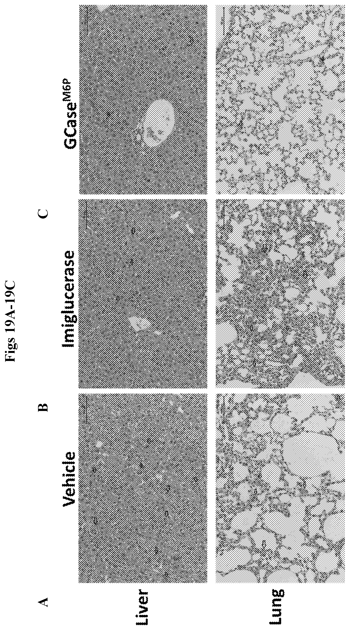 Patent US12492412 Figure 20 – Vector compositions and methods of using same for treatment of lysosomal storage disorders