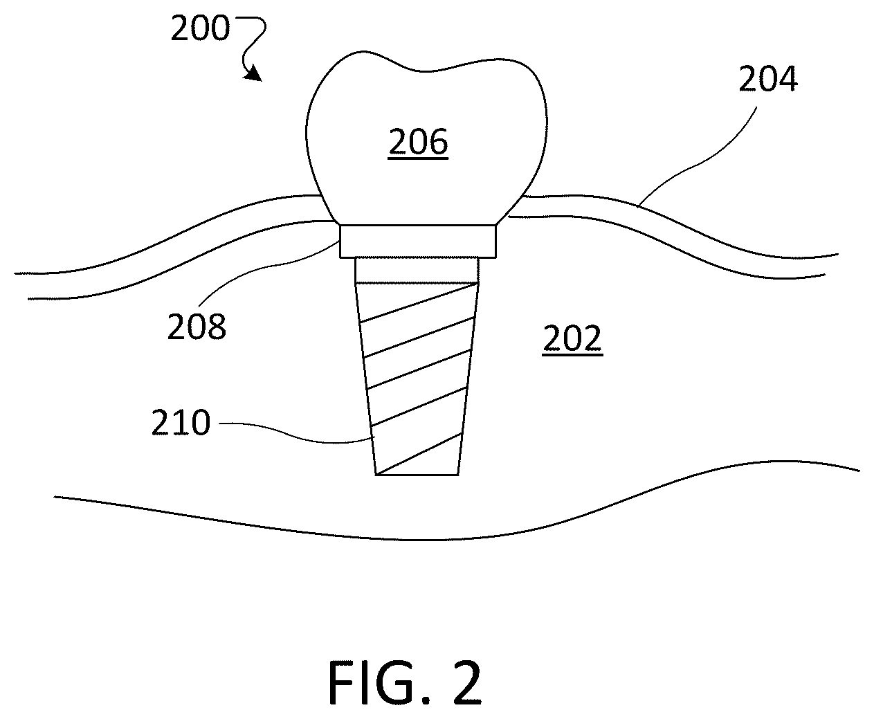 Patent US12492466 Figure 2 – Protective ceramic coatings for metal substrates