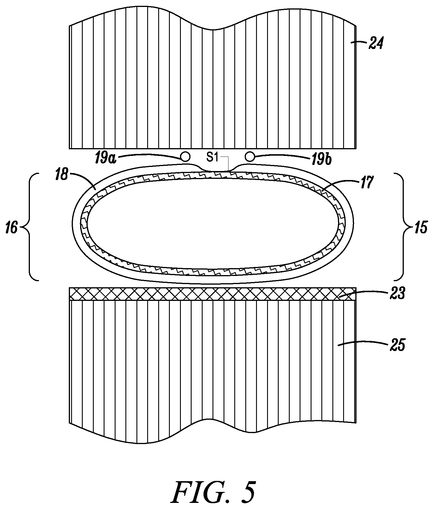 Patent US12492550 Figure 4 – Foam envelope for sealing large volumes