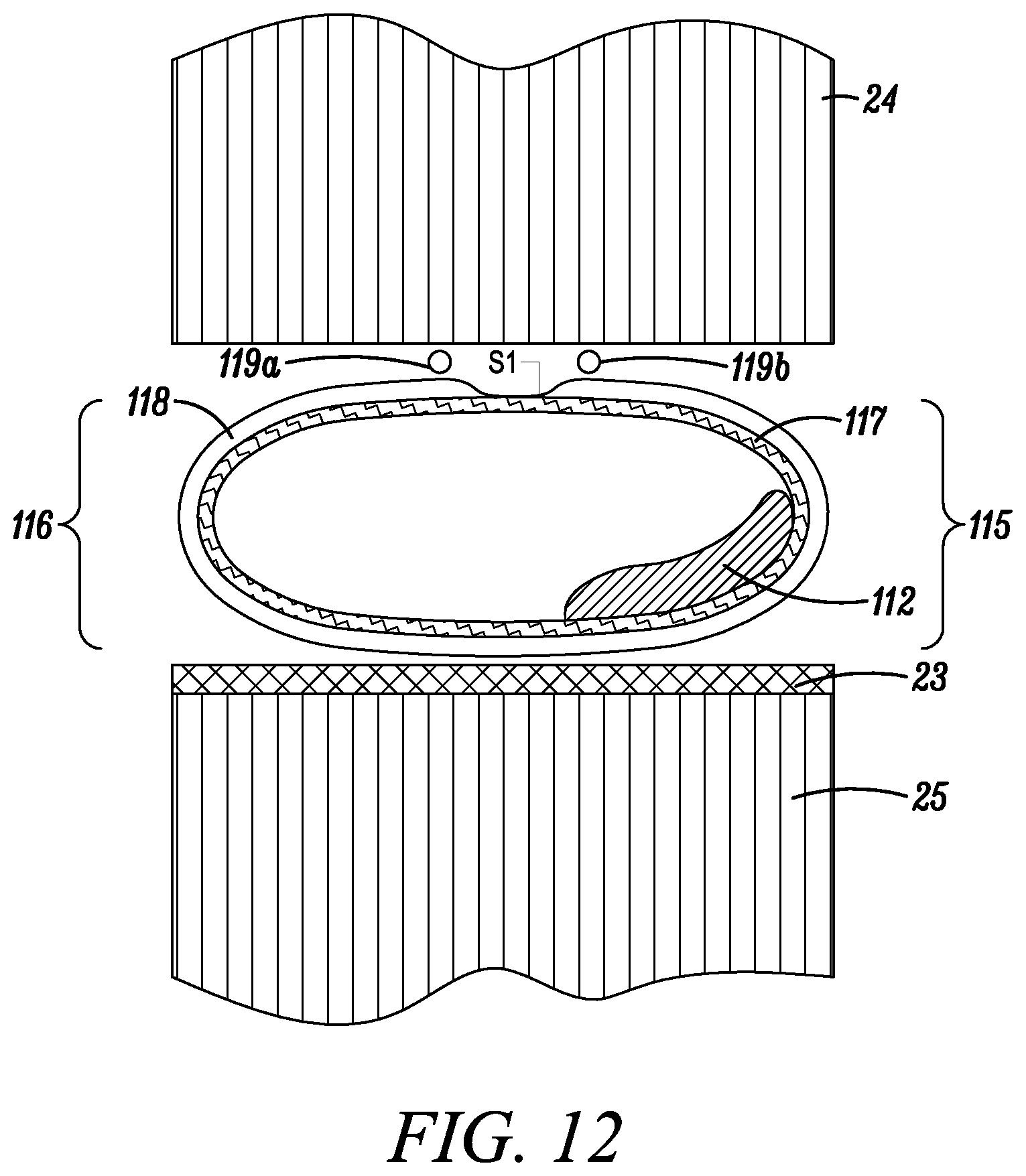 Patent US12492550 Figure 10 – Foam envelope for sealing large volumes