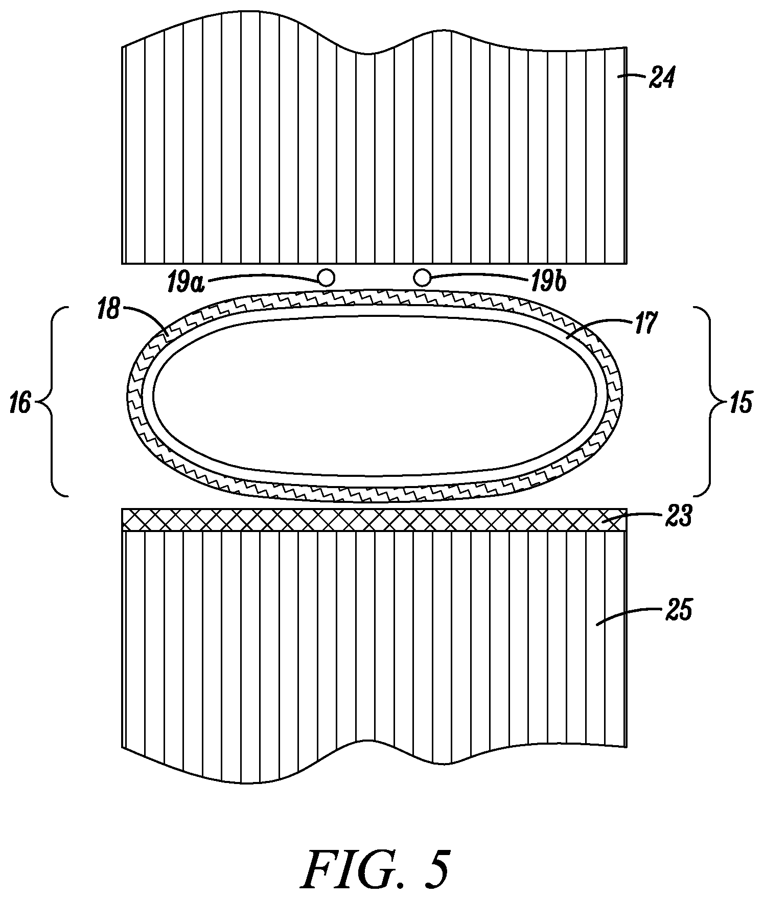 Patent US12492551 Figure 4 – Foam envelope for sealing large volumes