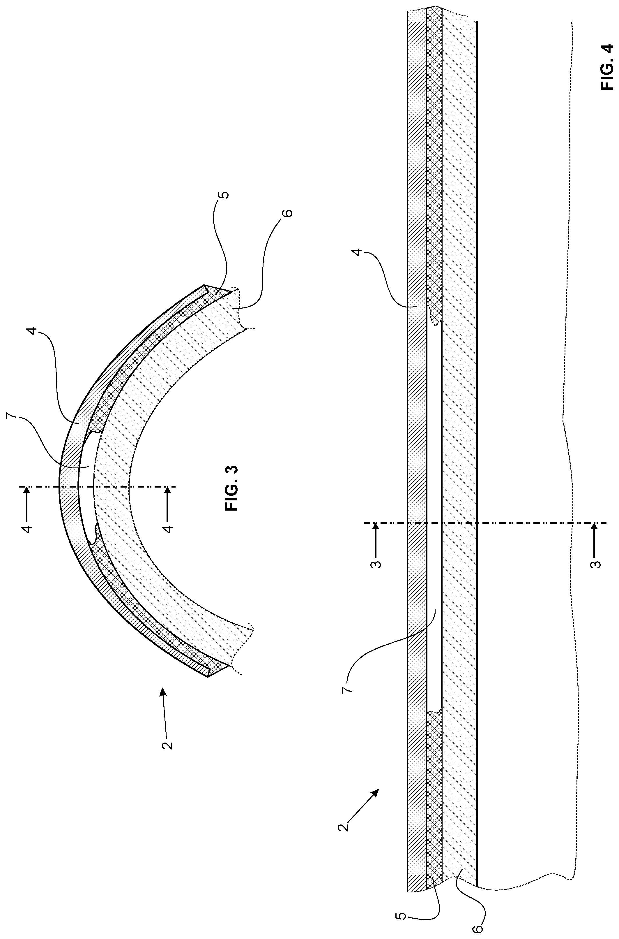 Patent US12492681 Figure 2 – Method and tool for detecting defects on a wind turbine generator blade