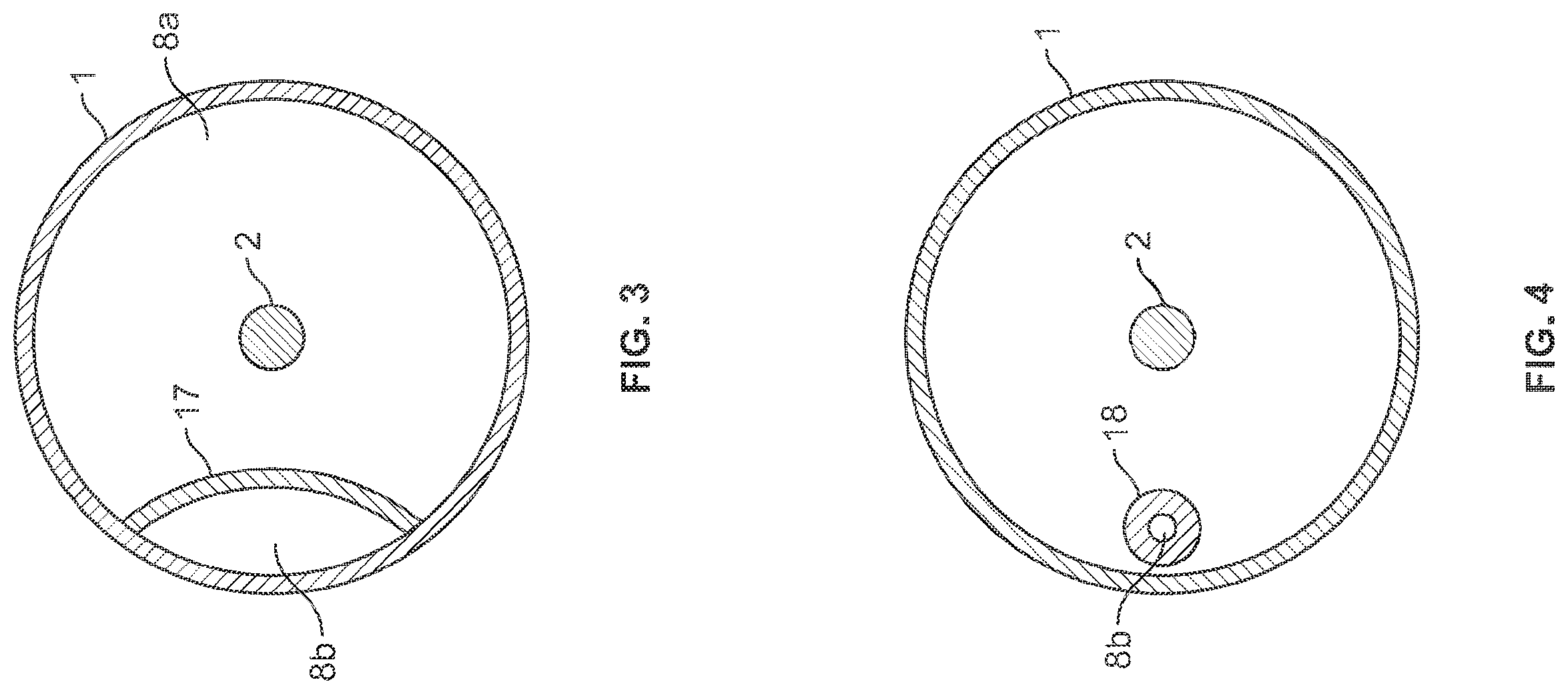 Patent US12492692 Figure 3 – Method for operating a supply device which supplies a liquid to a channel, and supply device, hollow catheter, and catheter pump