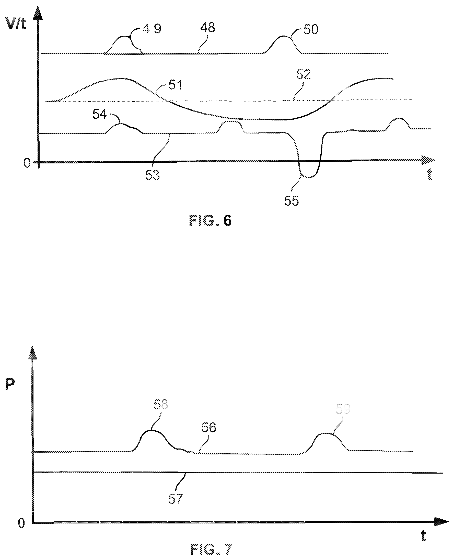 Patent US12492692 Figure 5 – Method for operating a supply device which supplies a liquid to a channel, and supply device, hollow catheter, and catheter pump
