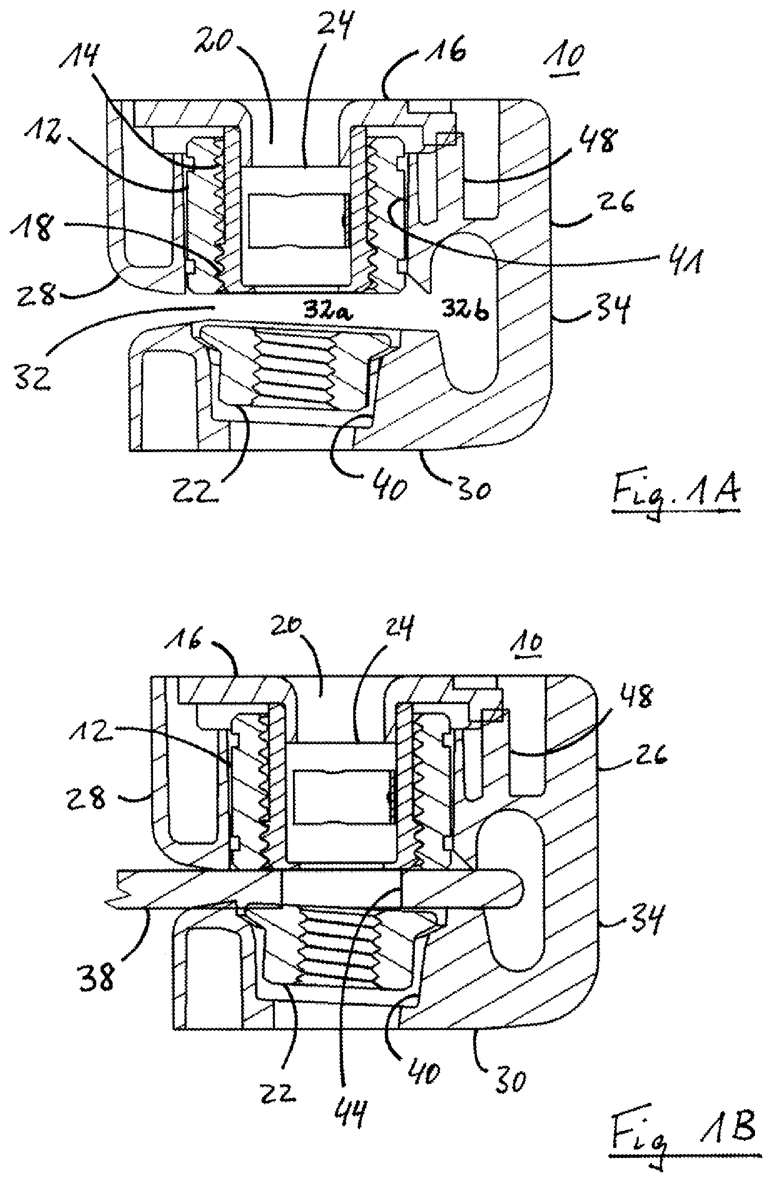 Patent US12492719 — Tolerance compensation device — Figure 1