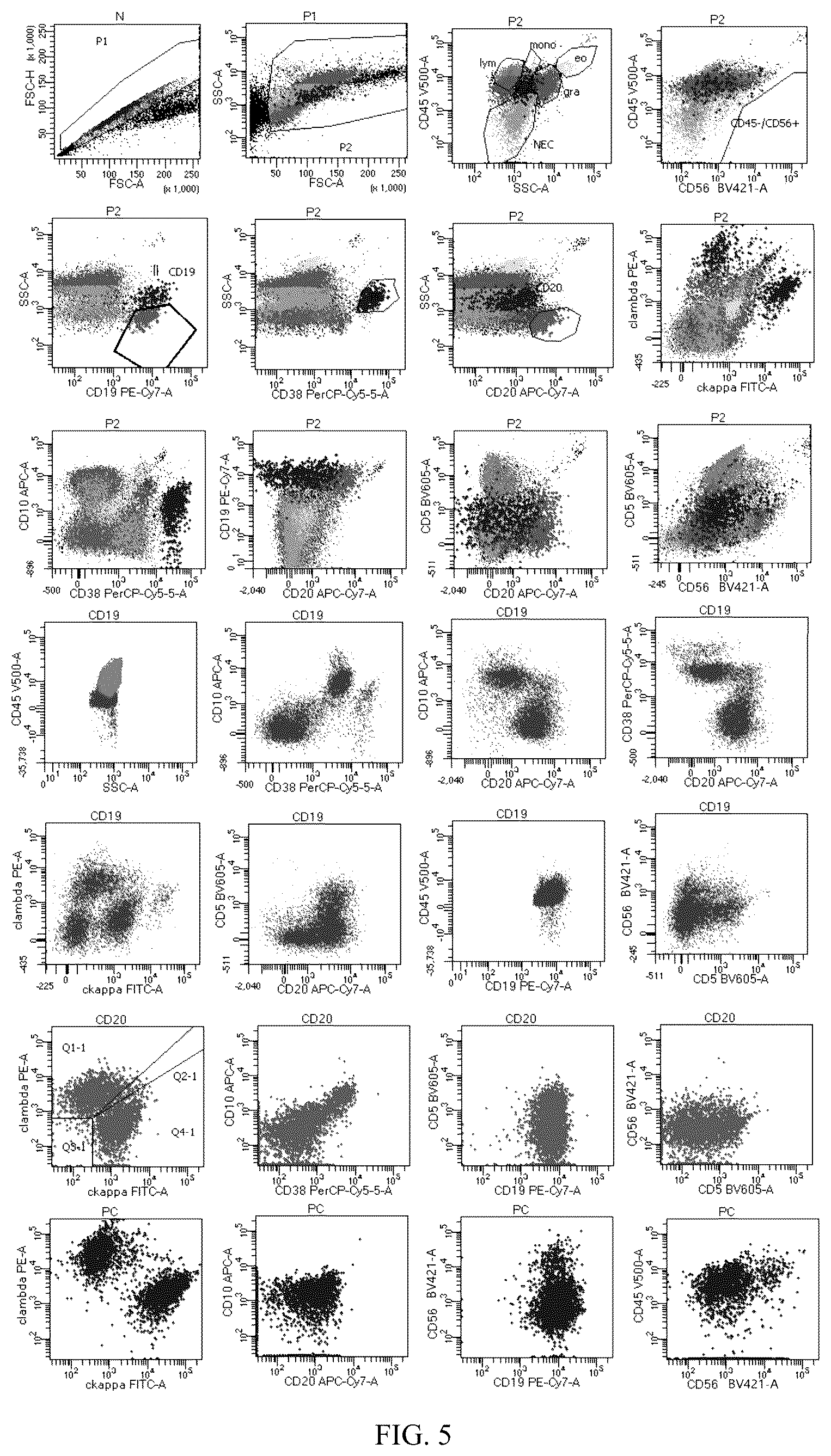 Patent US12492980 Figure 5 – Antibody combination for one-step screening and/or diagnosis of clonal diseases and related application