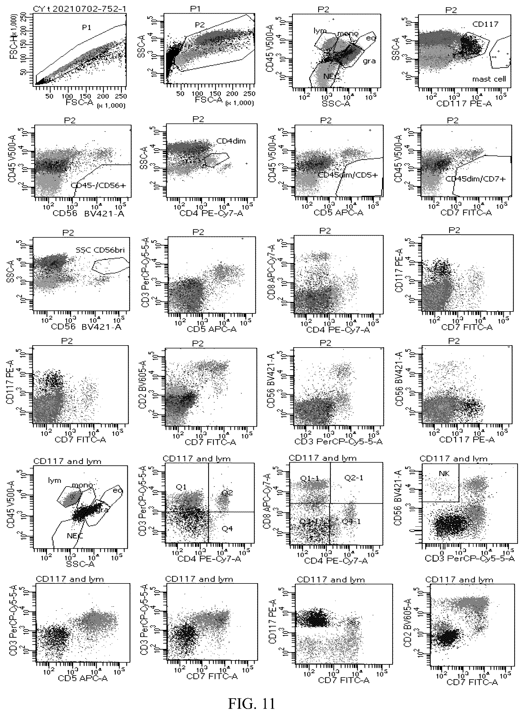 Patent US12492980 Figure 11 – Antibody combination for one-step screening and/or diagnosis of clonal diseases and related application