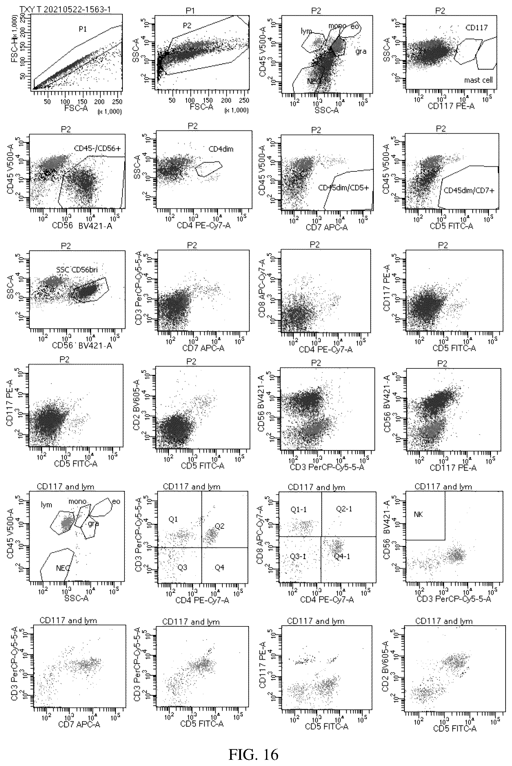 Patent US12492980 Figure 16 – Antibody combination for one-step screening and/or diagnosis of clonal diseases and related application