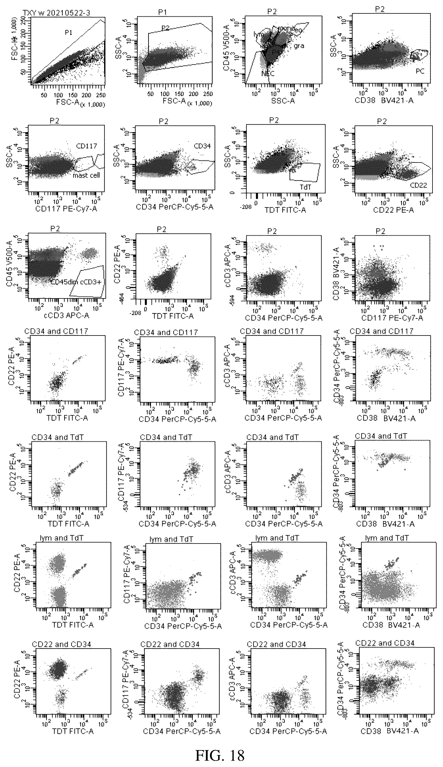 Patent US12492980 Figure 18 – Antibody combination for one-step screening and/or diagnosis of clonal diseases and related application