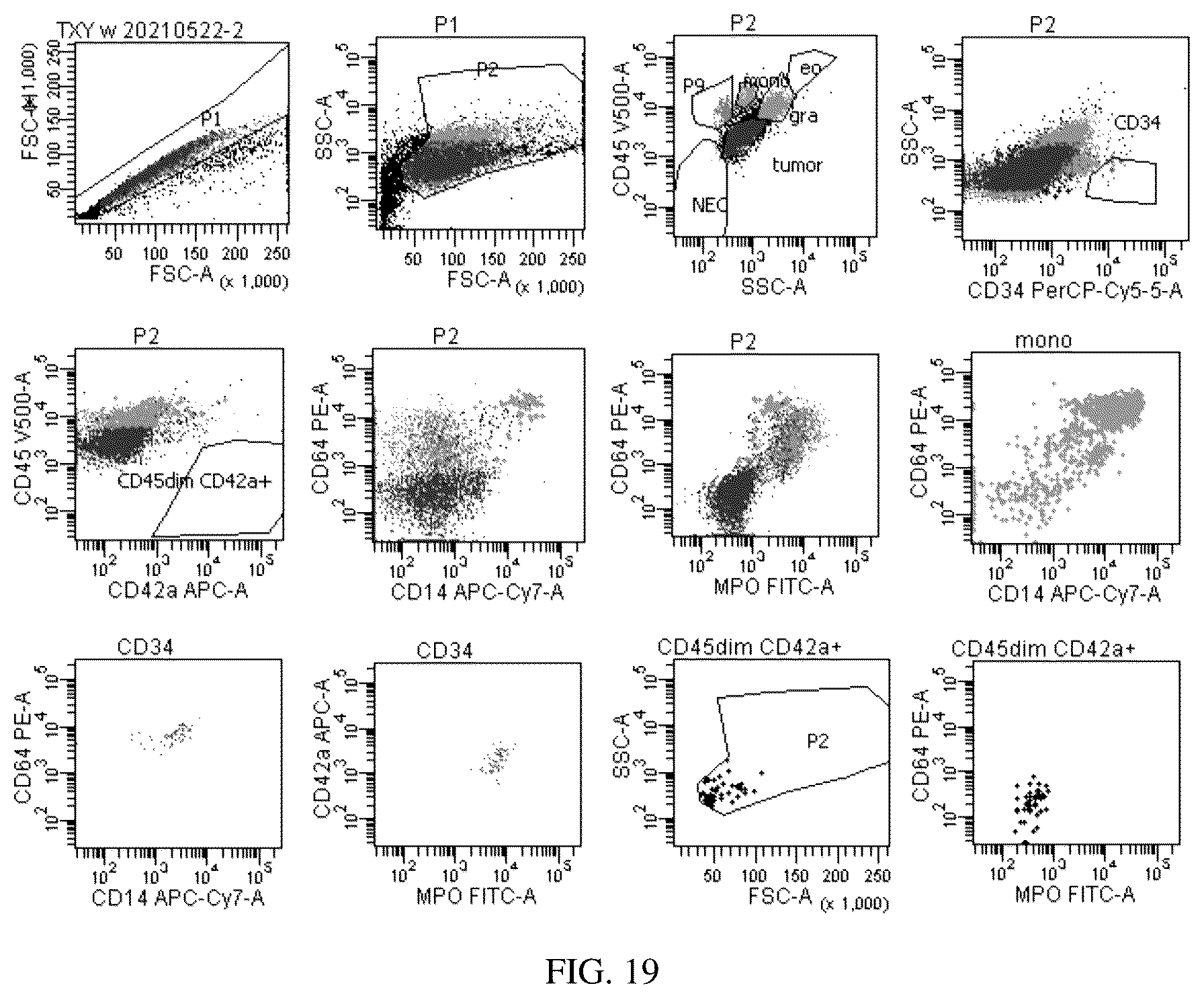 Patent US12492980 Figure 19 – Antibody combination for one-step screening and/or diagnosis of clonal diseases and related application