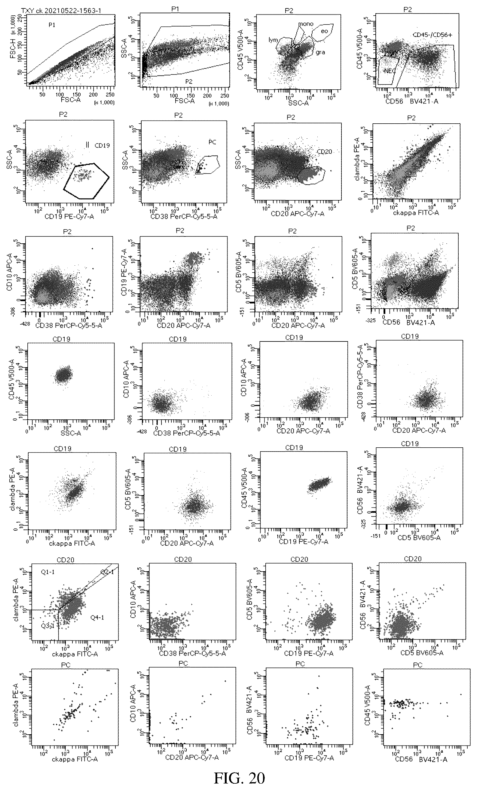 Patent US12492980 Figure 20 – Antibody combination for one-step screening and/or diagnosis of clonal diseases and related application