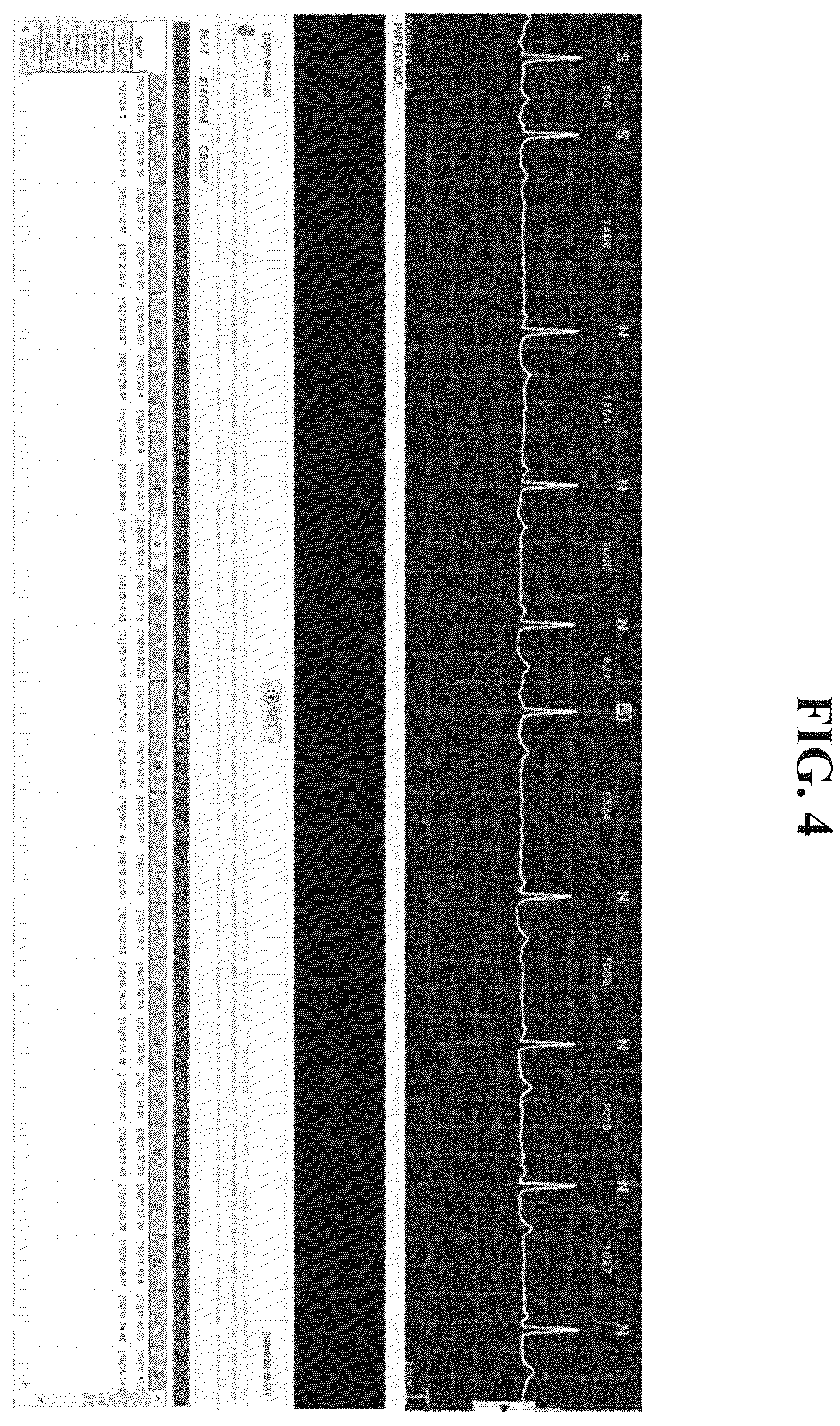Patent US12496006 Figure 3 – Method and apparatus for correcting electrocardiogram reading
